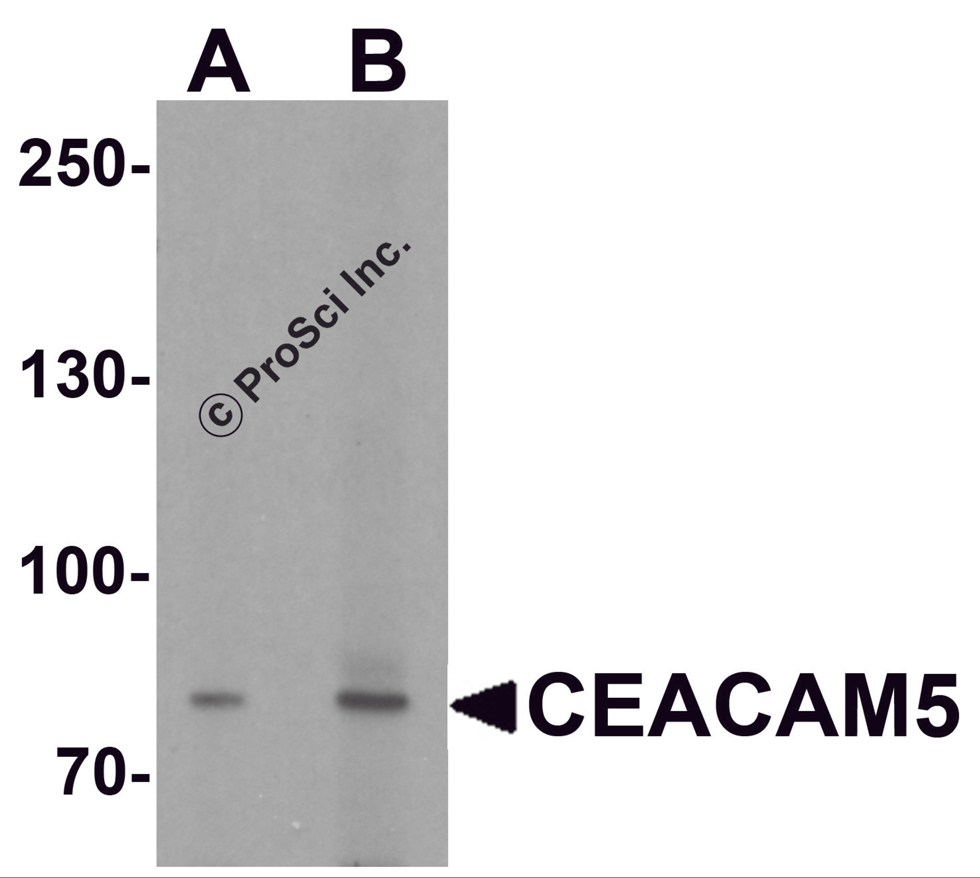 Western blot analysis of CEACAM5 in rat lung tissue lysate with CEACAM5 antibody at (A) 1 and (B) 2 &#956;g/ml.