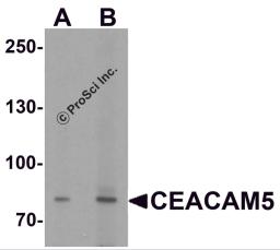 Western blot analysis of CEACAM5 in rat lung tissue lysate with CEACAM5 antibody at (A) 1 and (B) 2 μg/ml.