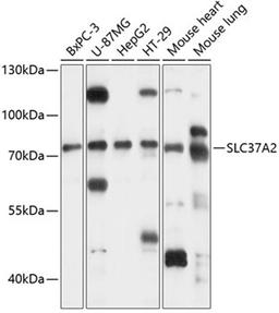 Western blot - SLC37A2 antibody (A14459)