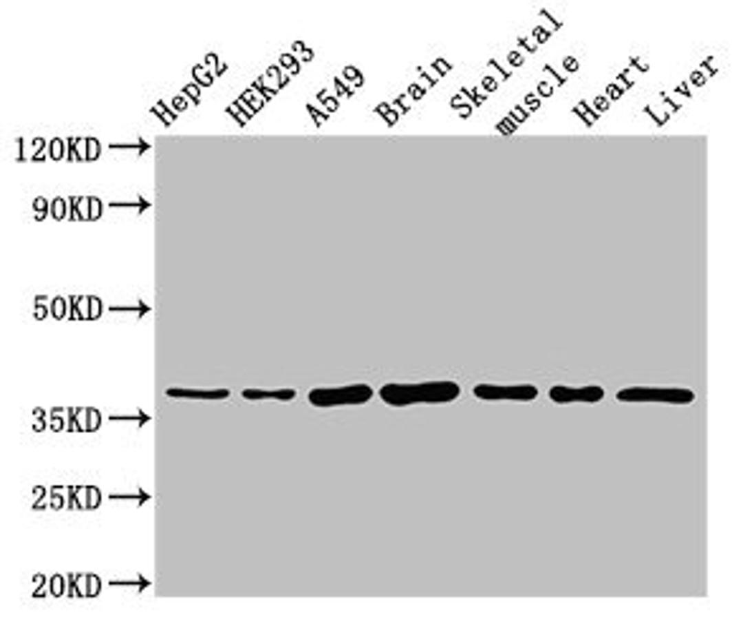 Western Blot. Positive WB detected in: HepG2 whole cell lysate, HEK293 whole cell lysate, A549 whole cell lysate, Mouse brain tissue, Mouse skeletal muscle tissue, Rat heart tissue, Rat liver tissue. All lanes: MYF6 antibody at 3µg/ml. Secondary. Goat polyclonal to rabbit IgG at 1/50000 dilution. Predicted band size: 27 kDa. Observed band size: 37 kDa