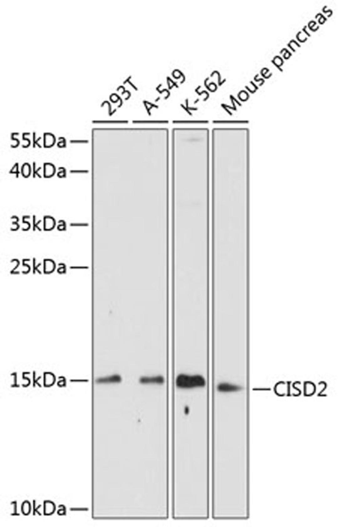 Western blot - CISD2 antibody (A14168)