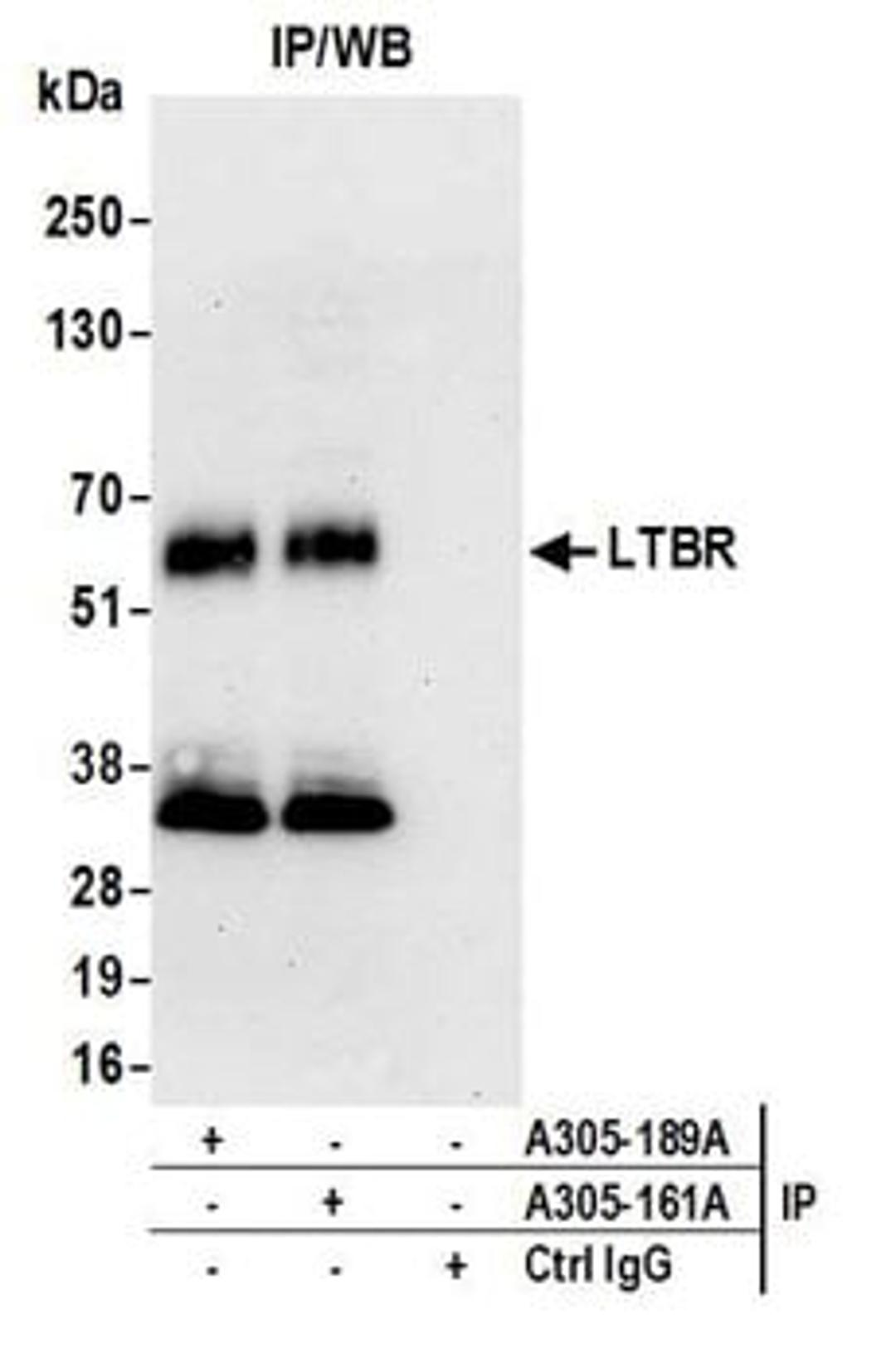 Detection of human LTBR by western blot of immunoprecipitates.