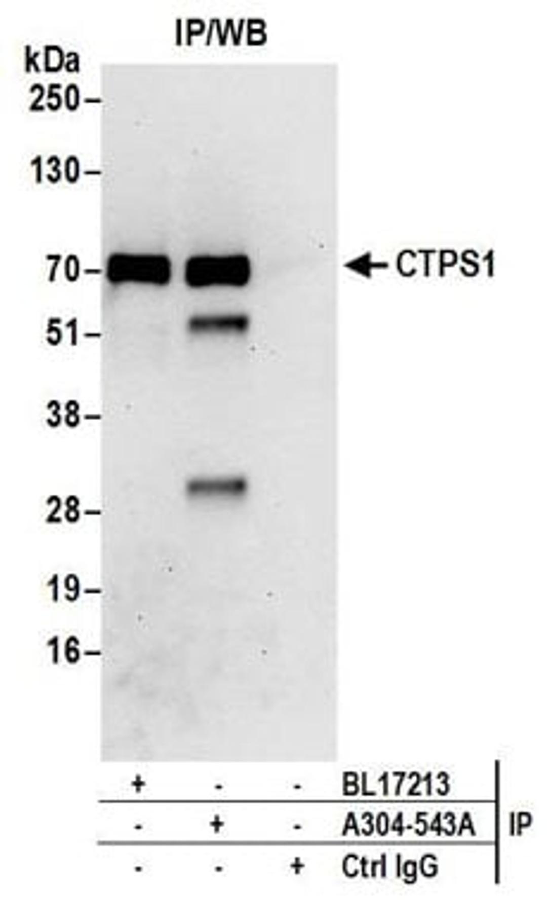 Detection of human CTPS1 by western blot of immunoprecipitates.