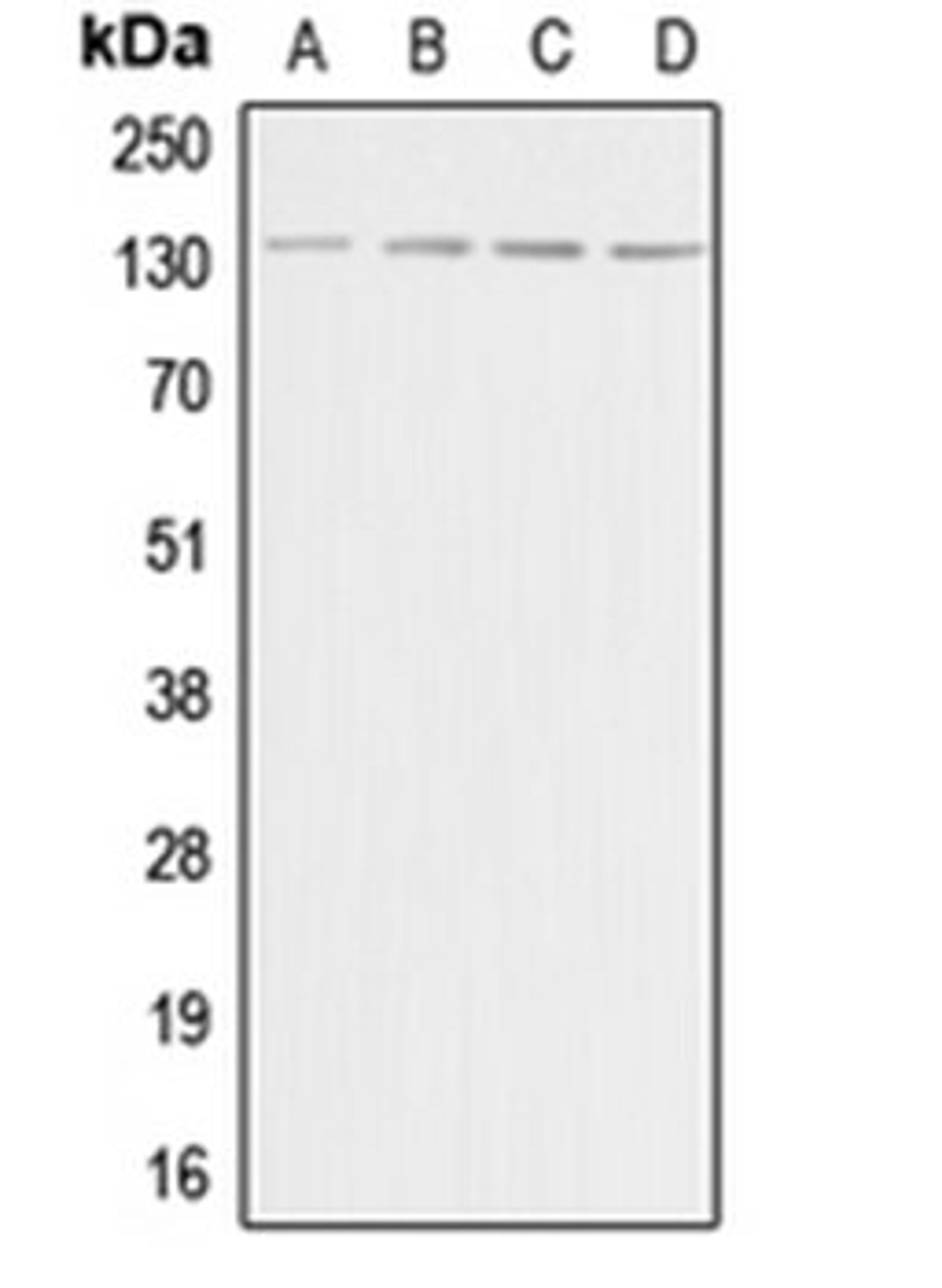 Western blot analysis of HeLa (Lane 1), Raw264.7 (Lane 2), PC12 (Lane 3), rat brain (Lane 4) whole cell lysates using ADCY5 antibody