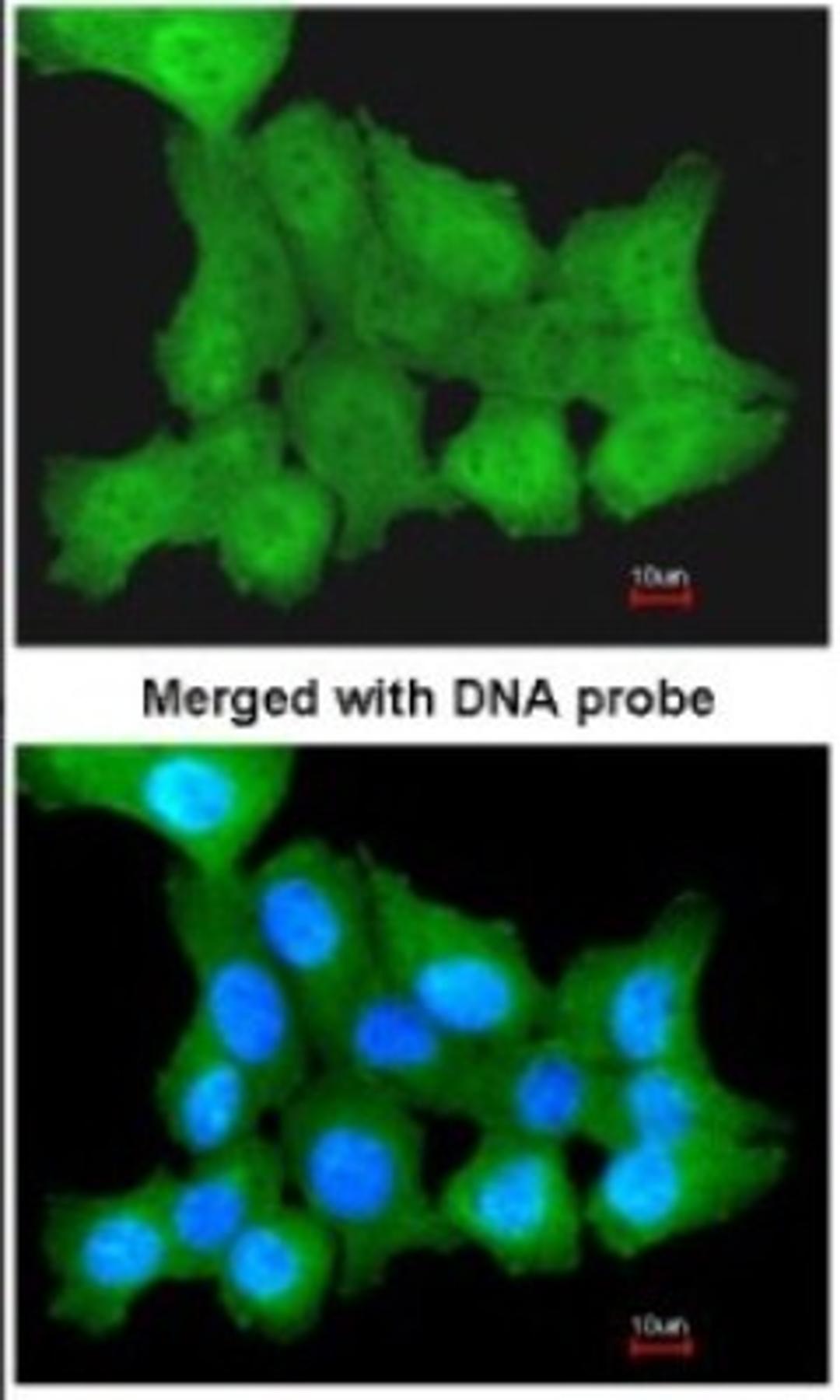 Immunocytochemistry/Immunofluorescence: ZNF259 Antibody [NBP1-32965] - Paraformaldehyde-fixed A431, using antibody at 1:200 dilution.