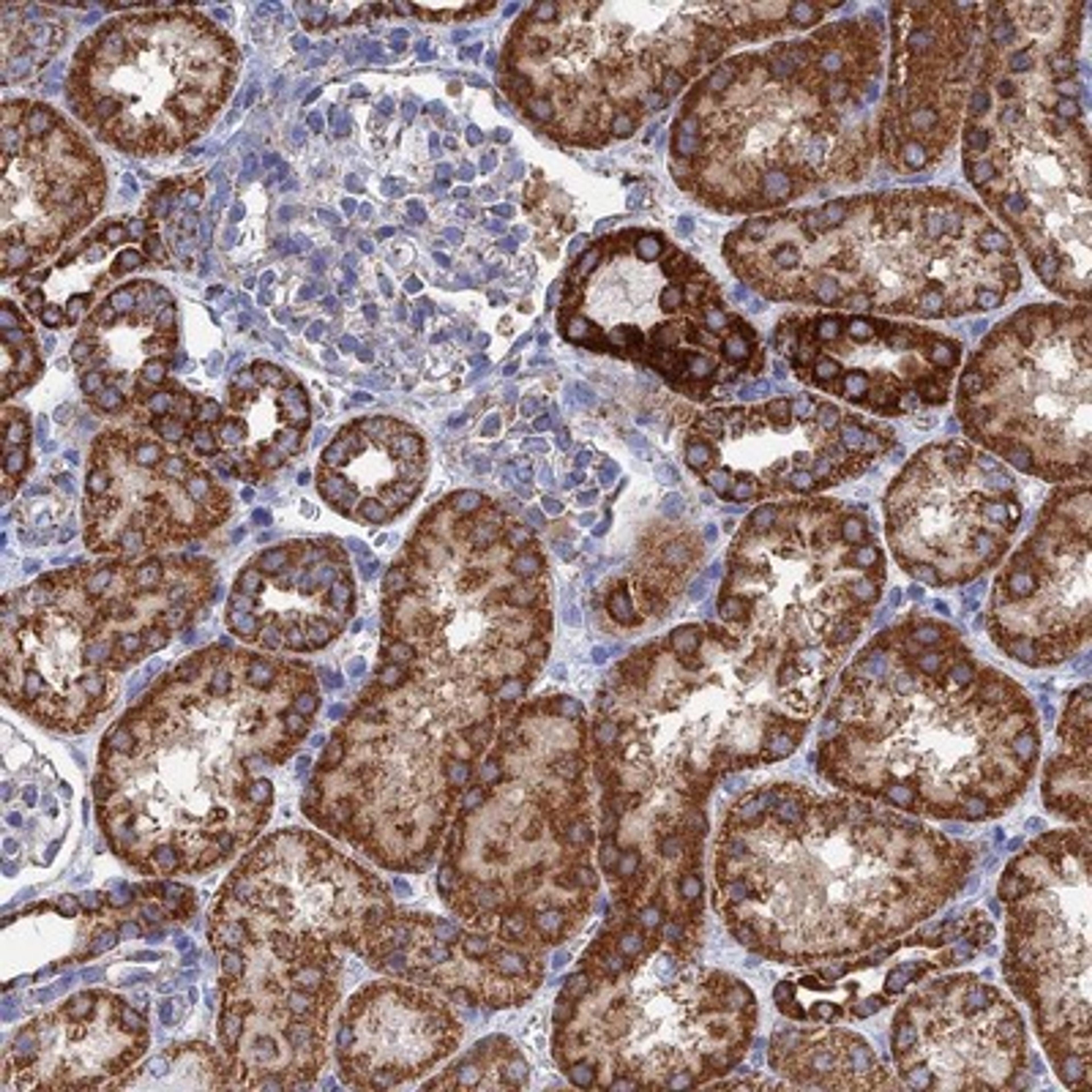 Immunohistochemistry-Paraffin: Aquaporin-11 Antibody [NBP1-86208] - Staining of human kidney shows strong cytoplasmic positivity in cells in tubules.