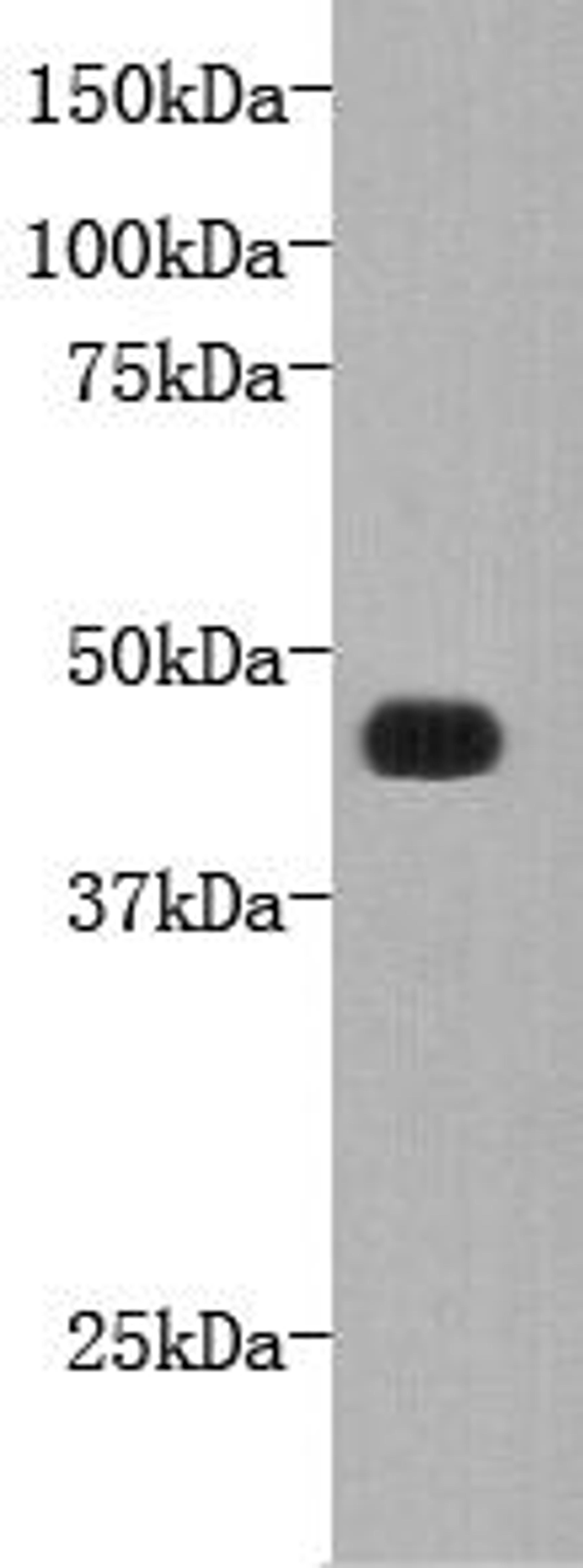 Western Blot analysis of recombiant FAT4 using FAT tumor suppressor homolog 4 antibody