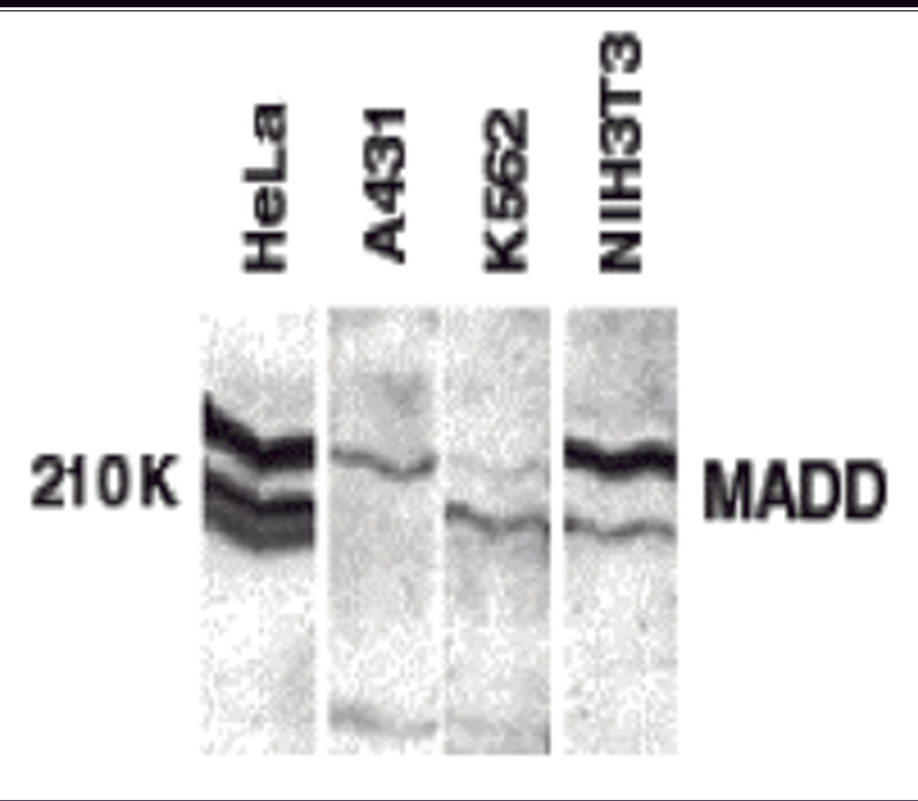 Western blot analysis of MADD in whole cell lysates from the indicated cell lines with MADD antibody at 1:250 dilution.