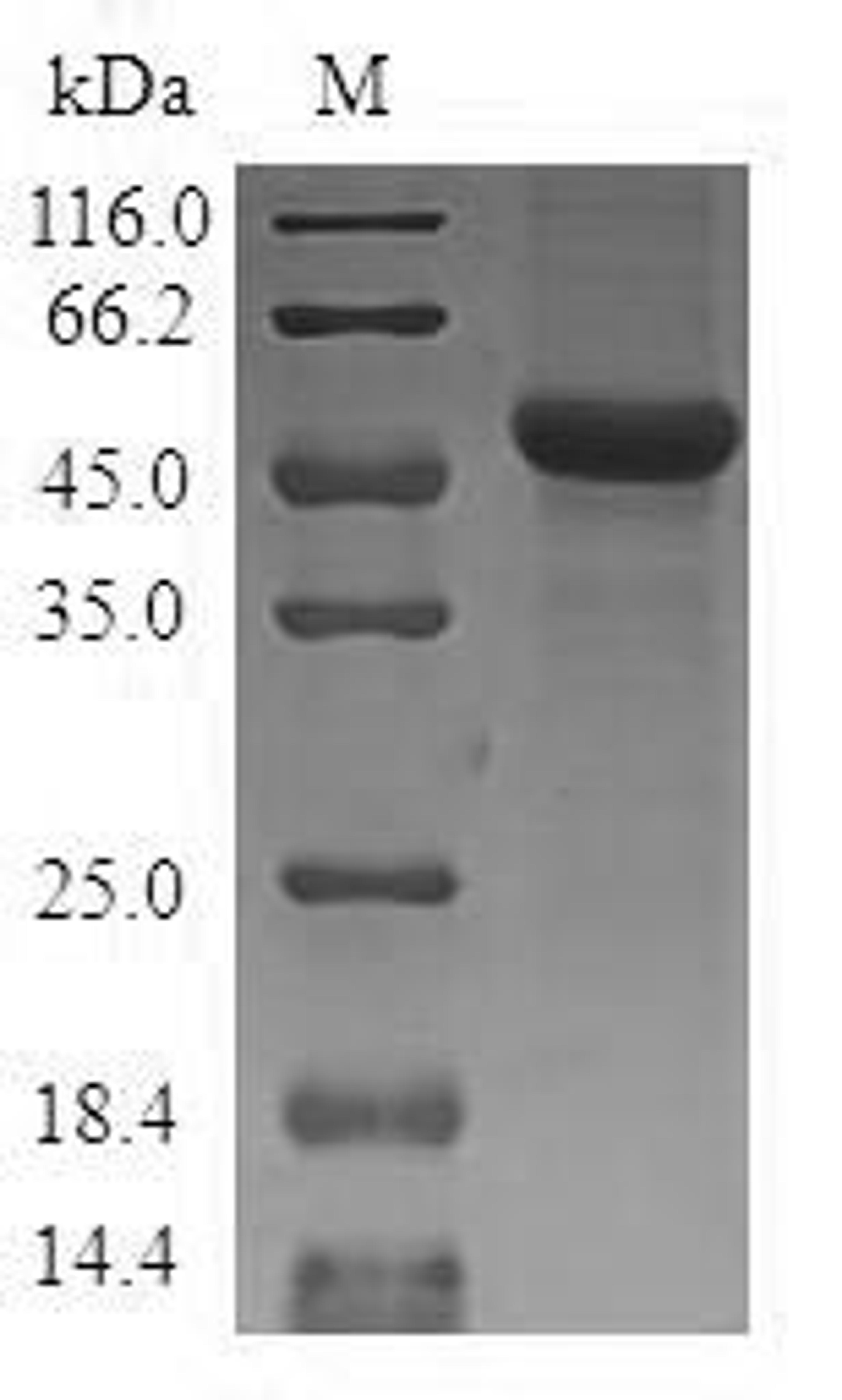 (Tris-Glycine gel) Discontinuous SDS-PAGE (reduced) with 5% enrichment gel and 15% separation gel.