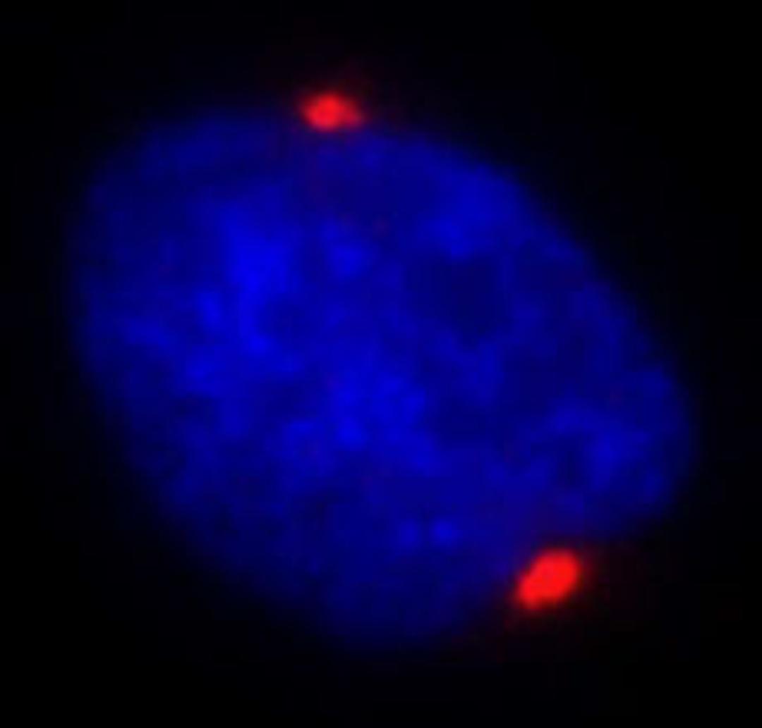 Detection of human Pericentrin/Kendrin by immunocytochemistry.