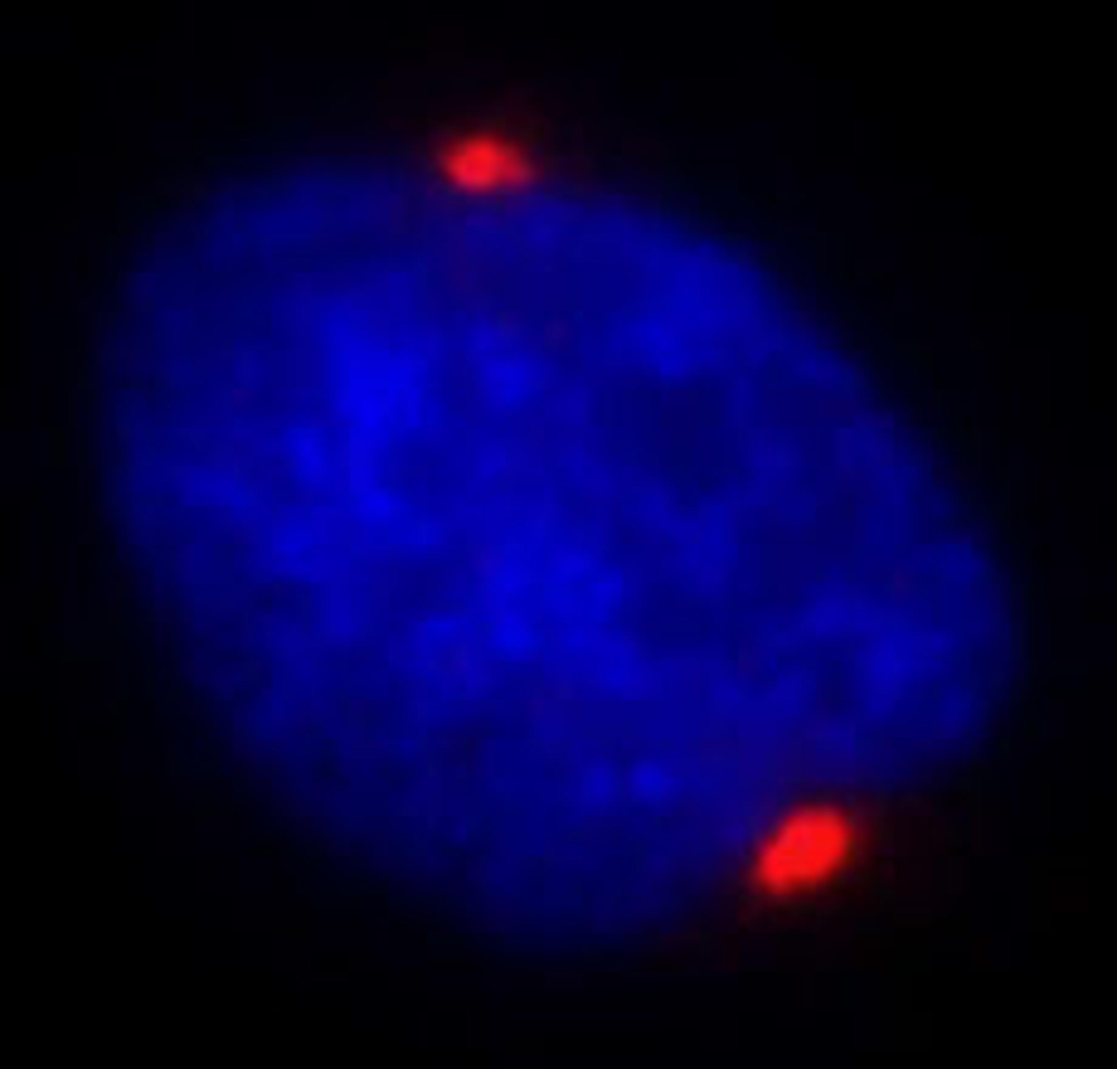 Detection of human Pericentrin/Kendrin by immunocytochemistry.