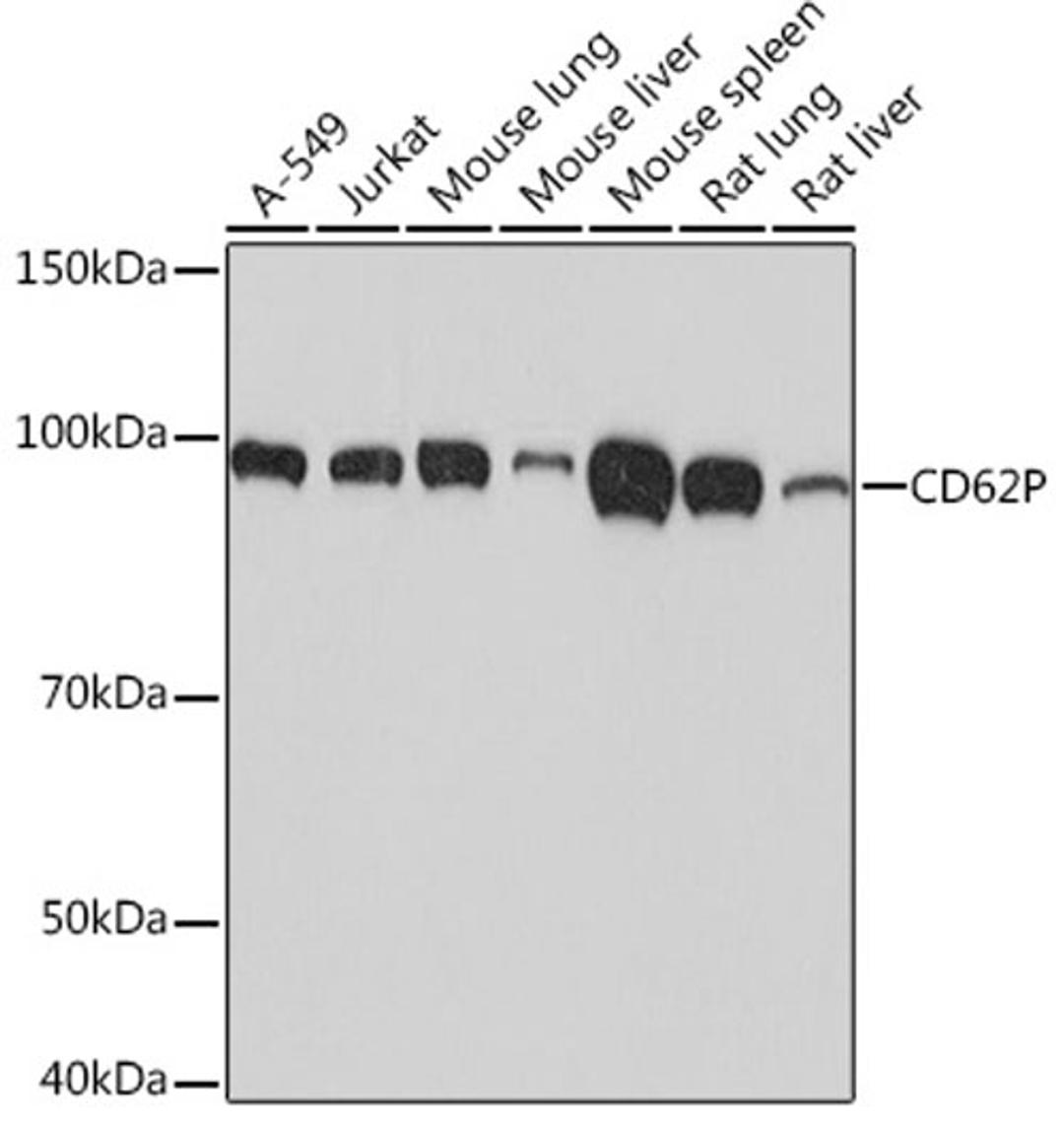 Western blot - CD62P Rabbit mAb (A4989)