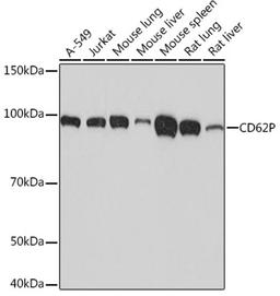 Western blot - CD62P Rabbit mAb (A4989)