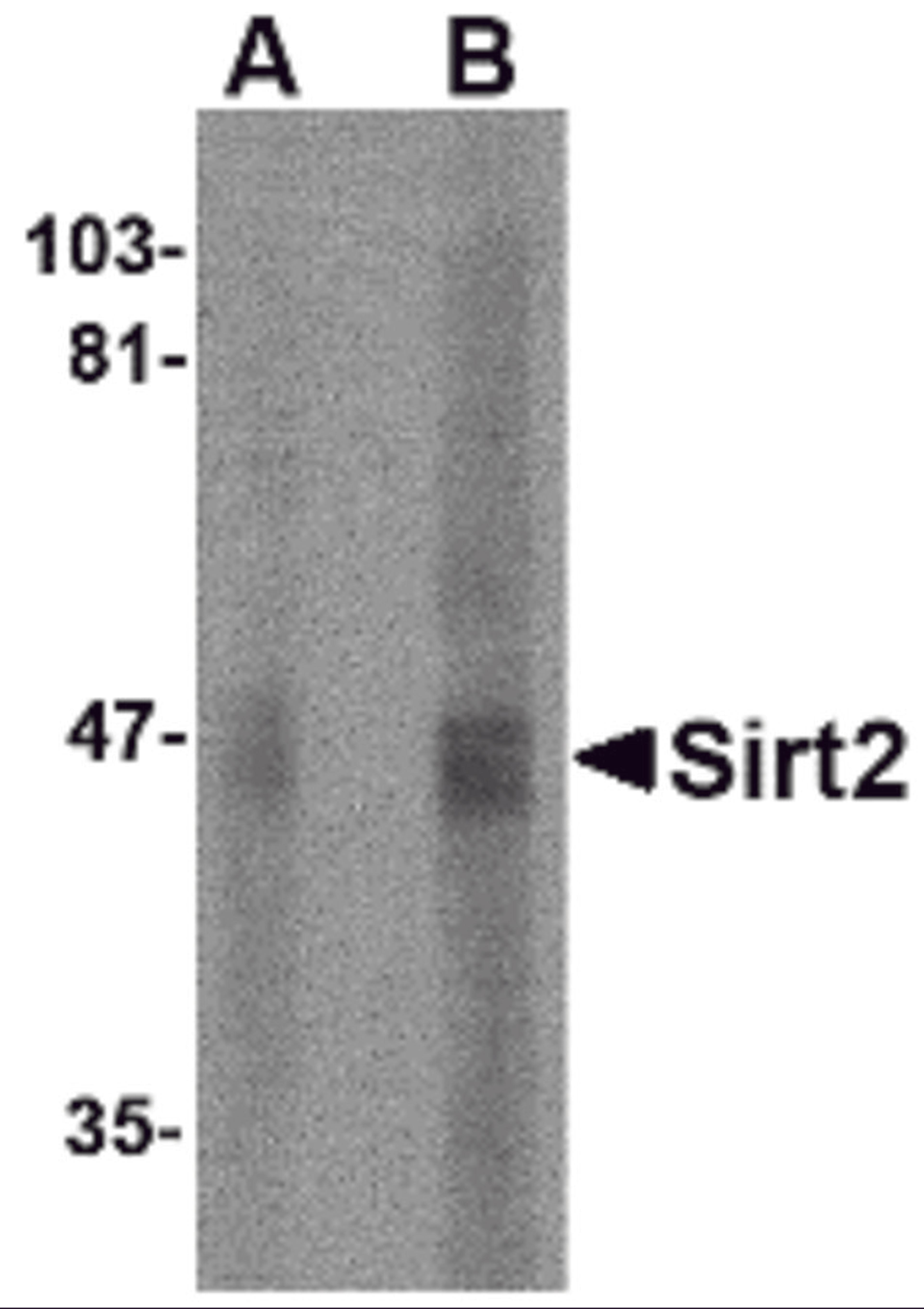 Western blot analysis of SIRT2 in human brain lysate with SIRT2 antibody at (A) 2.5 and (B) 5 &#956;g/mL.