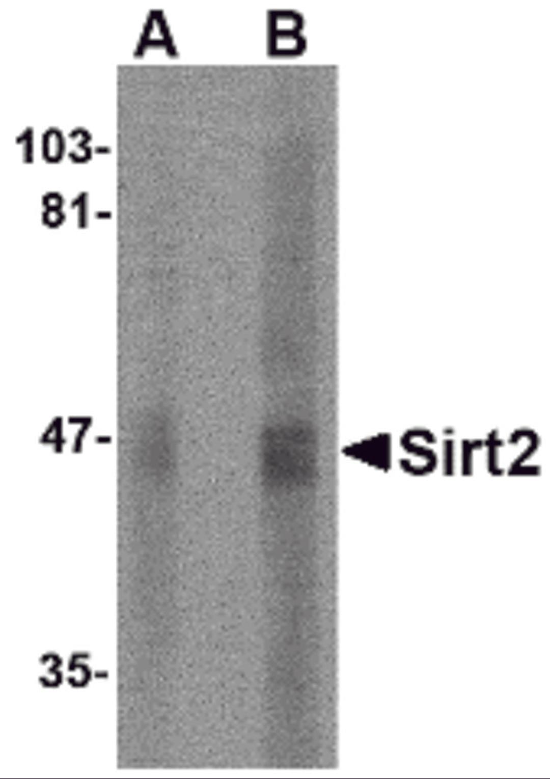 Western blot analysis of SIRT2 in human brain lysate with SIRT2 antibody at (A) 2.5 and (B) 5 μg/mL.