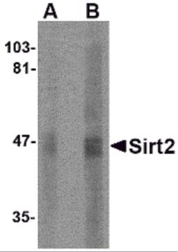 Western blot analysis of SIRT2 in human brain lysate with SIRT2 antibody at (A) 2.5 and (B) 5 μg/mL.