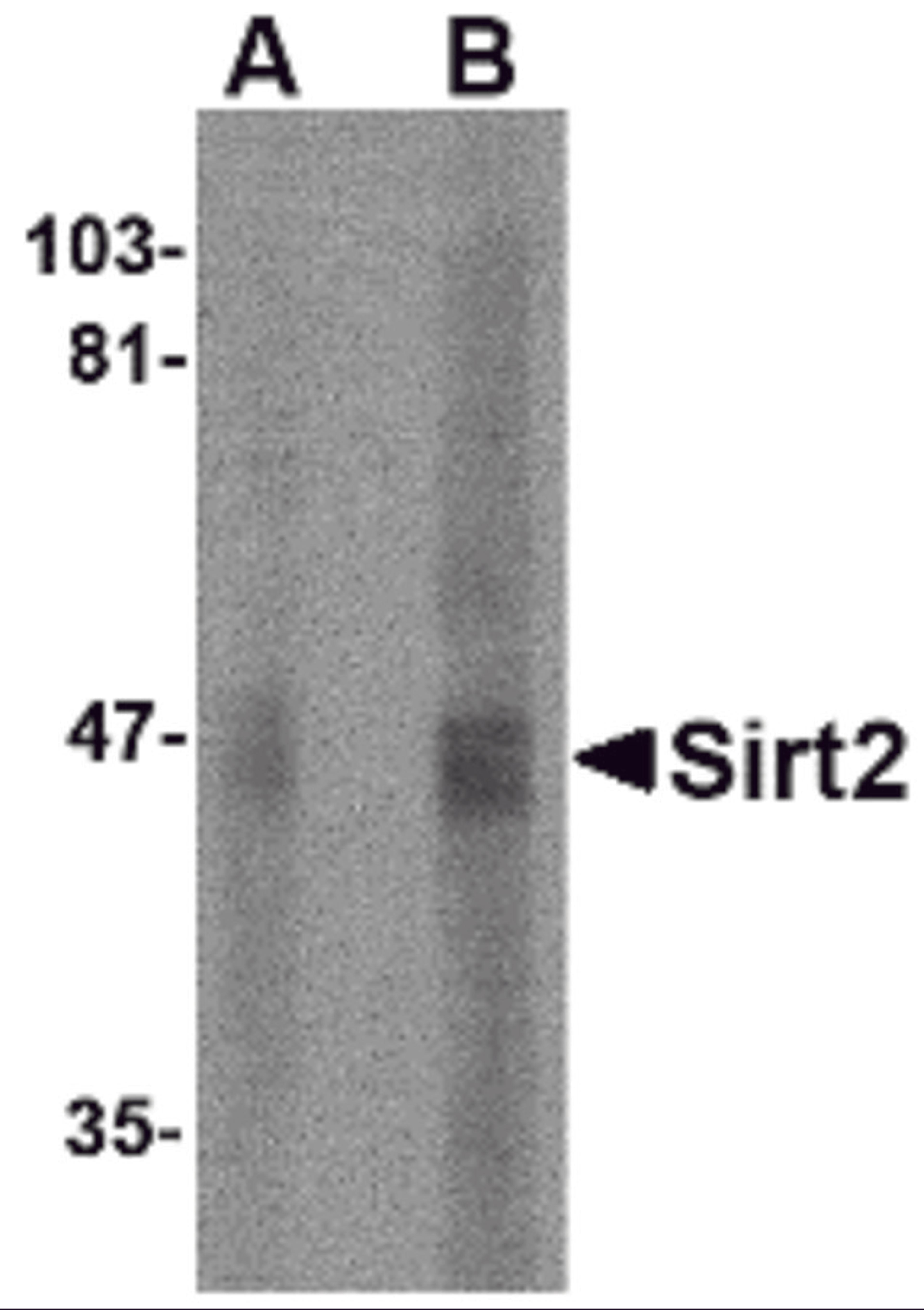 Western blot analysis of SIRT2 in human brain lysate with SIRT2 antibody at (A) 2.5 and (B) 5 μg/mL.