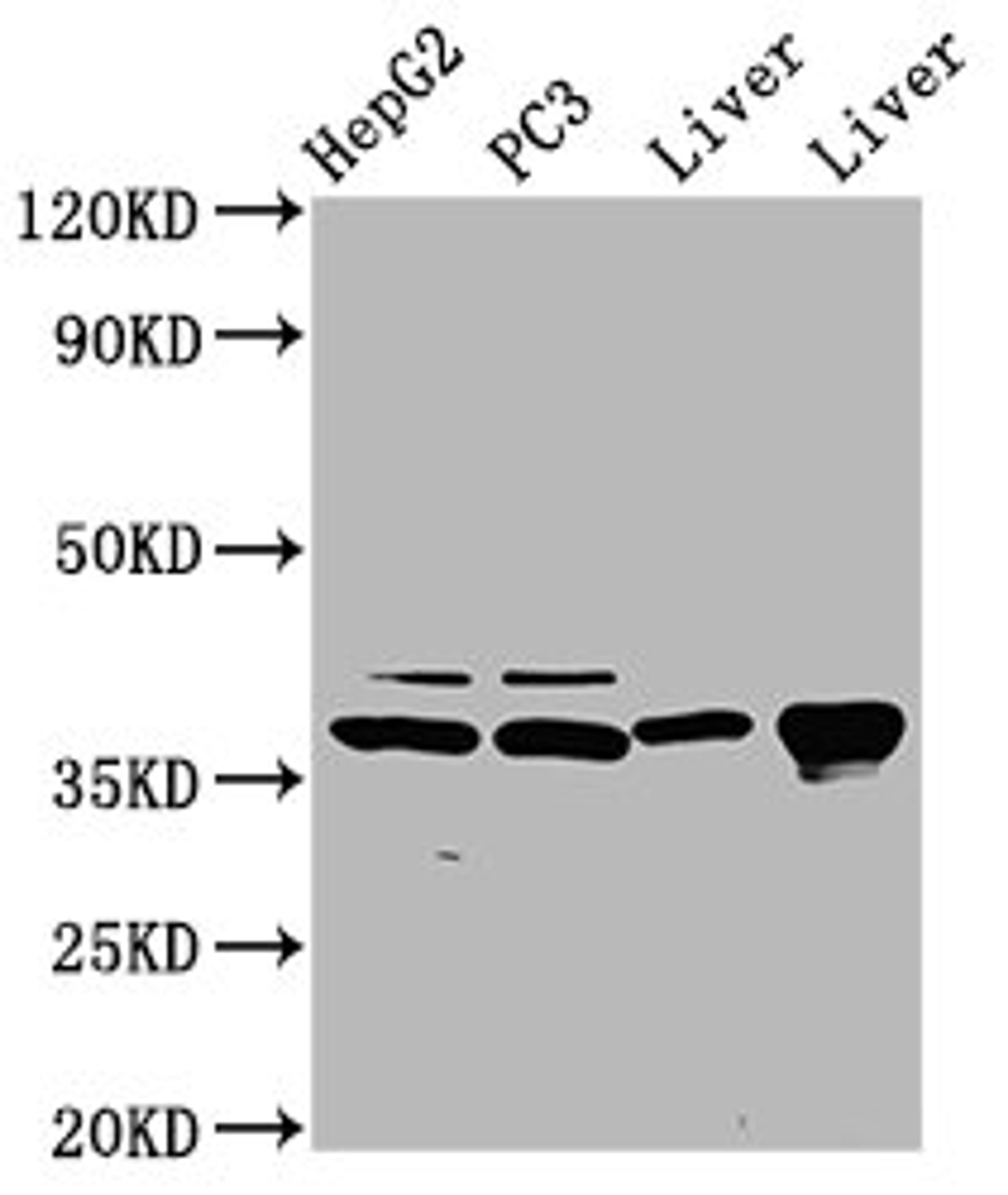 Western Blot. Positive WB detected in: HepG2 whole cell lysate, PC-3 whole cell lysate, Rat liver tissue, Mouse liver tissue. All lanes: E2F5 antibody at 5µg/ml. Secondary. Goat polyclonal to rabbit IgG at 1/50000 dilution. Predicted band size: 38, 21 kDa. Observed band size: 38 kDa