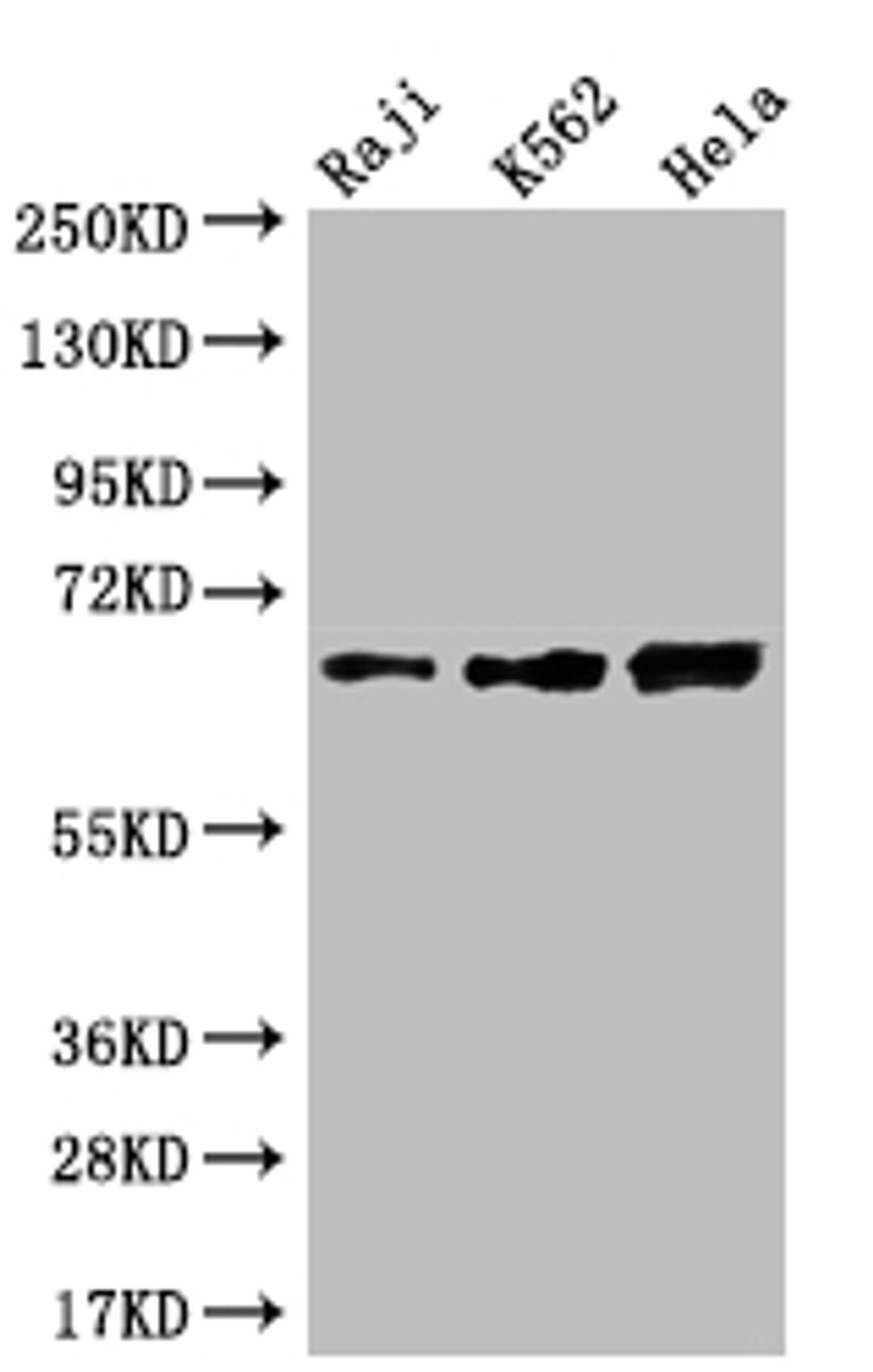Western Blot. Positive WB detected in: Raji whole cell lysate, K562 whole cell lysate, Hela whole cell lysate. All lanes: CD58 antibody at 1:2000. Secondary. Goat polyclonal to rabbit IgG at 1/50000 dilution. Predicted band size: 29, 27, 26 kDa. Observed band size: 55-70 kDa. 