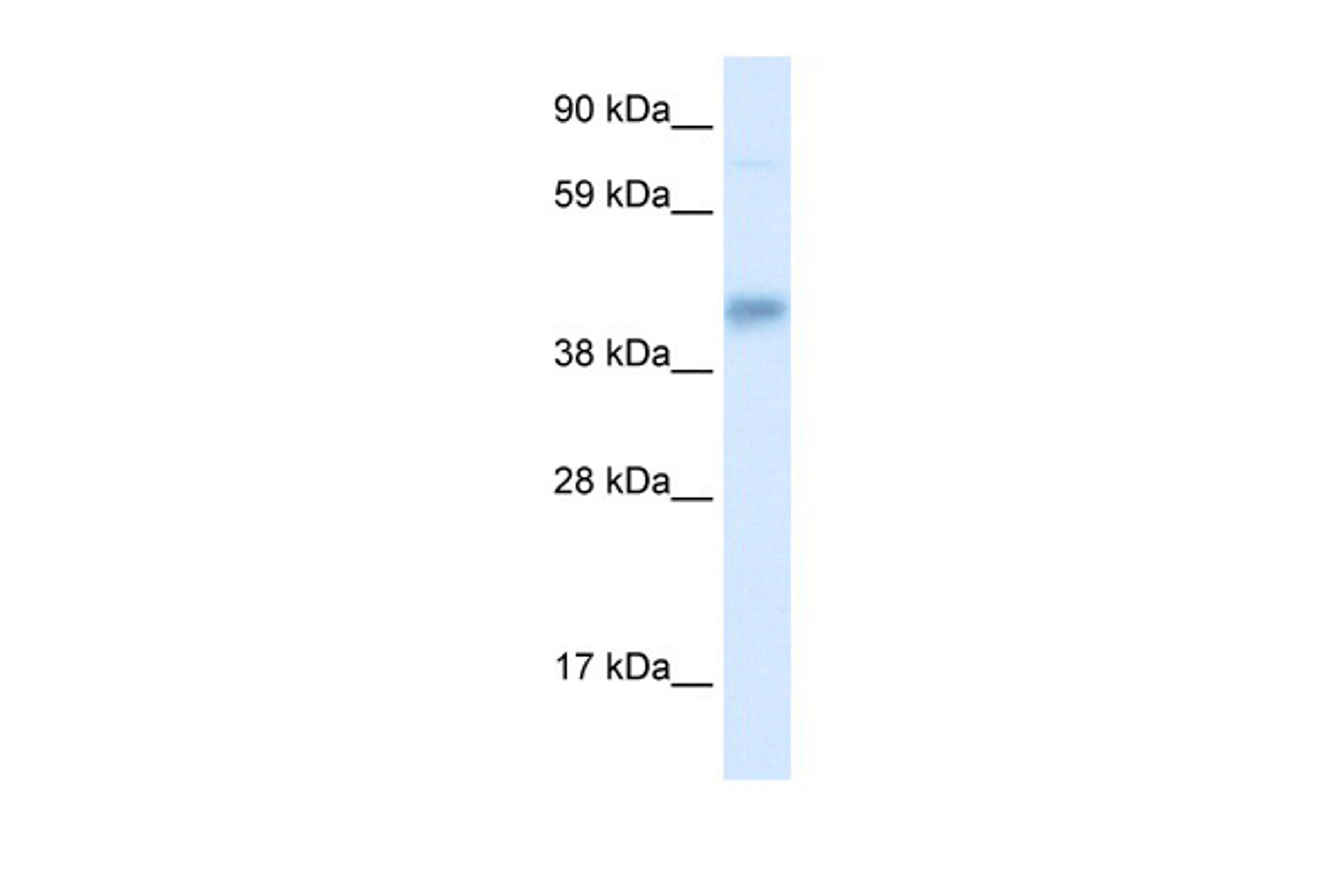 Antibody used in WB on Human Liver cell lysates at 0.2-1 ug/ml.