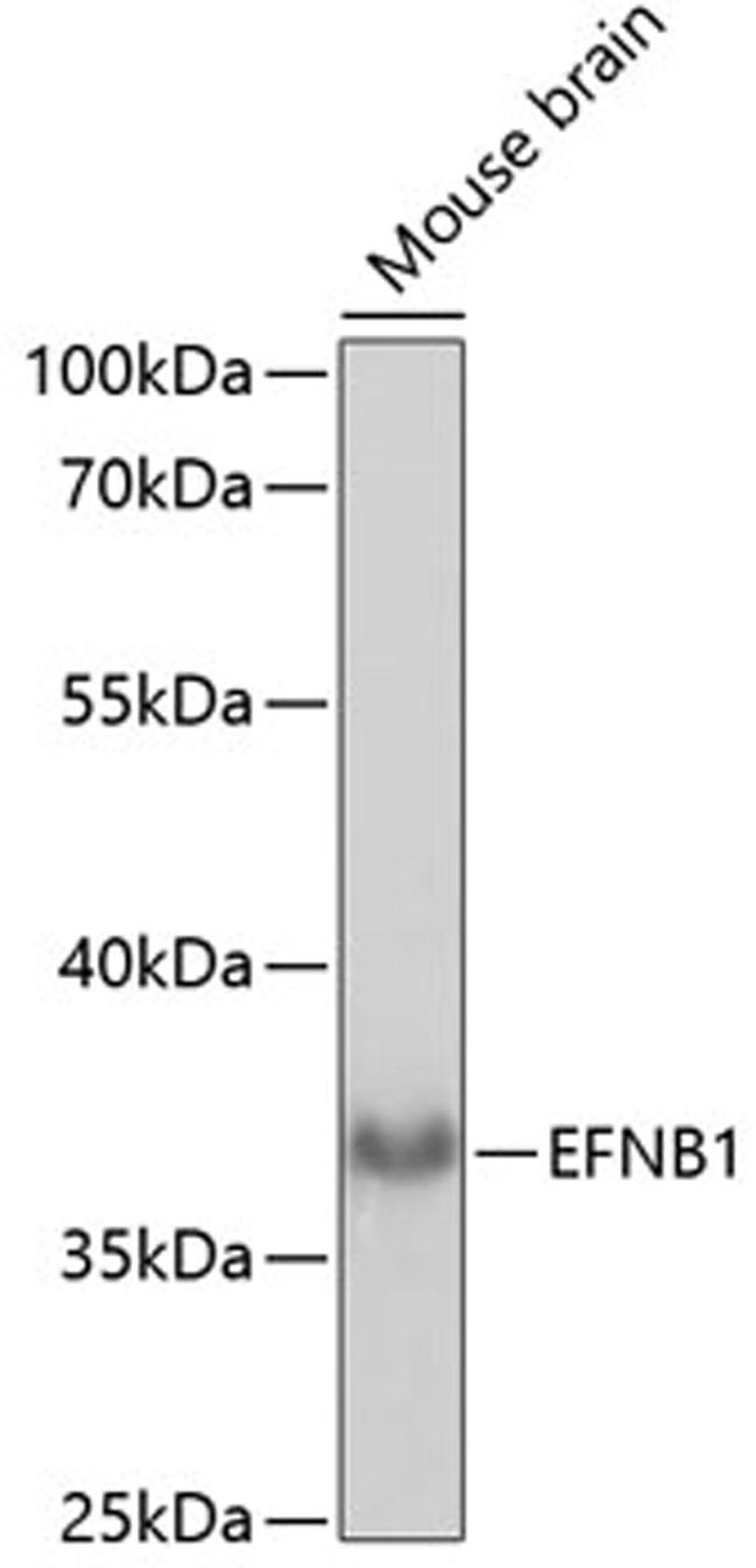 Western blot - EFNB1 antibody (A14562)