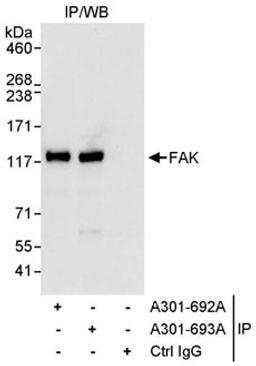 Detection of human FAK by western blot of immunoprecipitates.