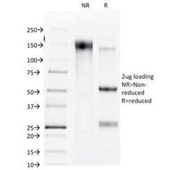 SDS-PAGE Analysis of Purified, BSA-Free Connexin 32 Antibody (clone R5.21C). Confirmation of Integrity and Purity of the Antibody.