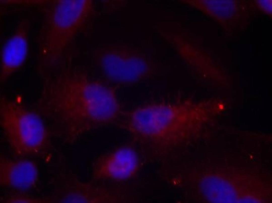 Immunocytochemistry/Immunofluorescence: PAK1/2/3 [p Thr423, p Thr402, p Thr421] Antibody [NB100-82131] - Staining of methanol-fixed Hela cells using PAK1/PAK2/PAK3(Phospho-Thr423/Thr402/Thr421) antibody