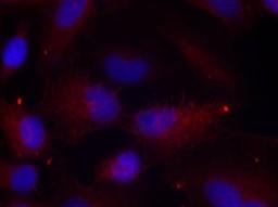 Immunocytochemistry/Immunofluorescence: PAK1/2/3 [p Thr423, p Thr402, p Thr421] Antibody [NB100-82131] - Staining of methanol-fixed Hela cells using PAK1/PAK2/PAK3(Phospho-Thr423/Thr402/Thr421) antibody