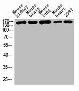 Western blot analysis of Mouse kidney tissue, Mouse brain tissue, Mouse lung tissue, Mouse heart tissue, 293T whole cell lysate, antibody was diluted at 1000. Secondary antibody was diluted at 1:20000