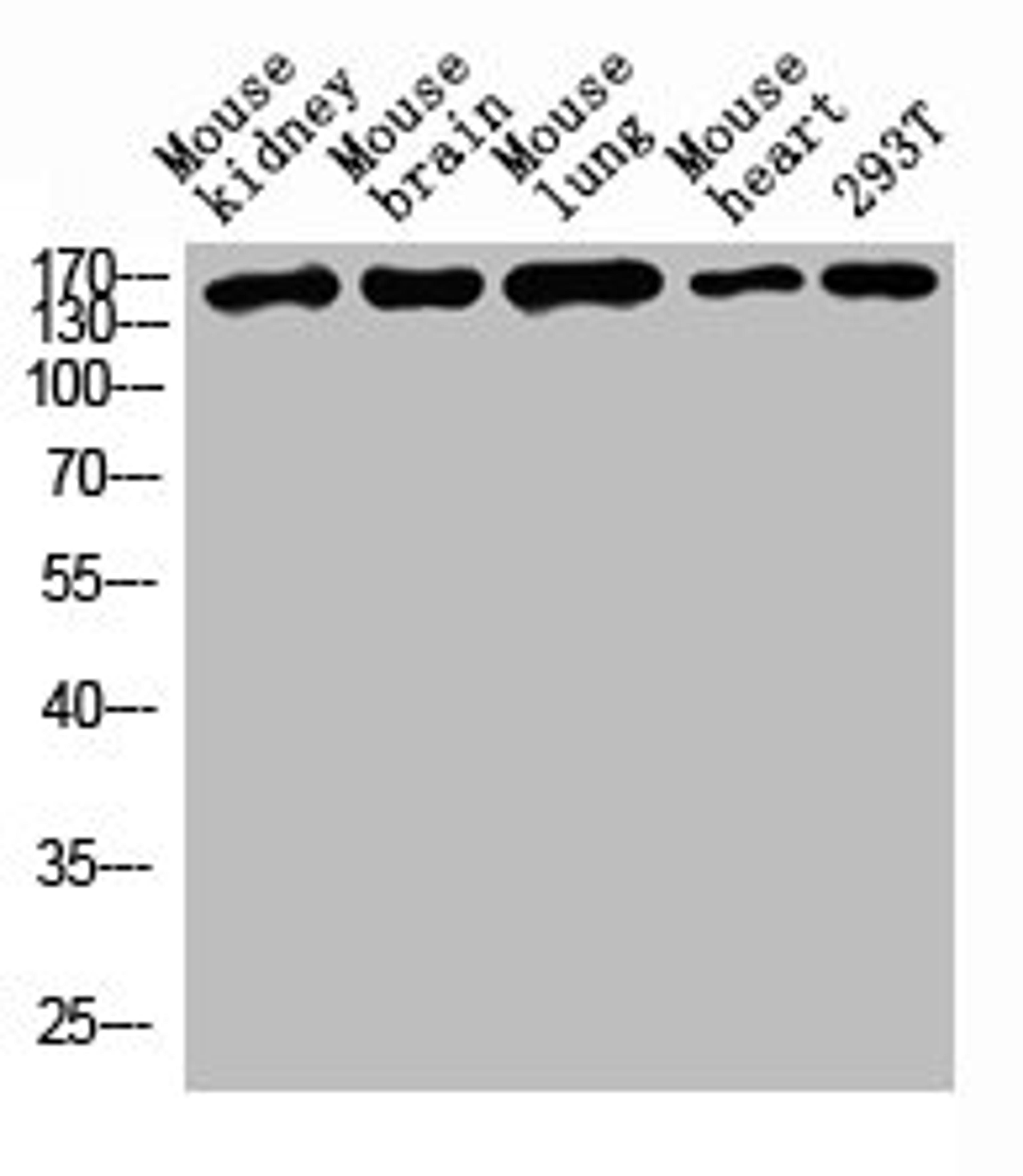 Western blot analysis of Mouse kidney tissue, Mouse brain tissue, Mouse lung tissue, Mouse heart tissue, 293T whole cell lysate, antibody was diluted at 1000. Secondary antibody was diluted at 1:20000