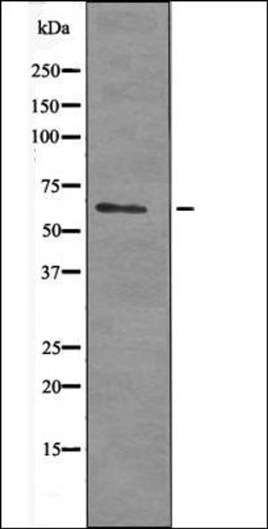 Western blot analysis of HeLa whole cell lysates using PAK1 -Phospho-Ser21- antibody