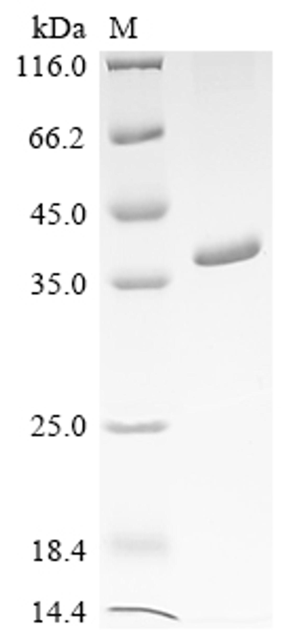 (Tris-Glycine gel) Discontinuous SDS-PAGE (reduced) with 5% enrichment gel and 15% separation gel.