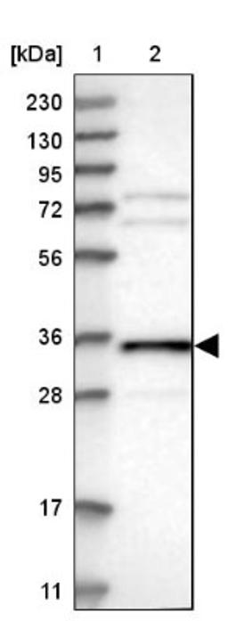 Western Blot: LRRC59 Antibody [NBP1-93952] - Lane 1: Marker [kDa] 230, 130, 95, 72, 56, 36, 28, 17, 11<br/>Lane 2: Human cell line RT-4