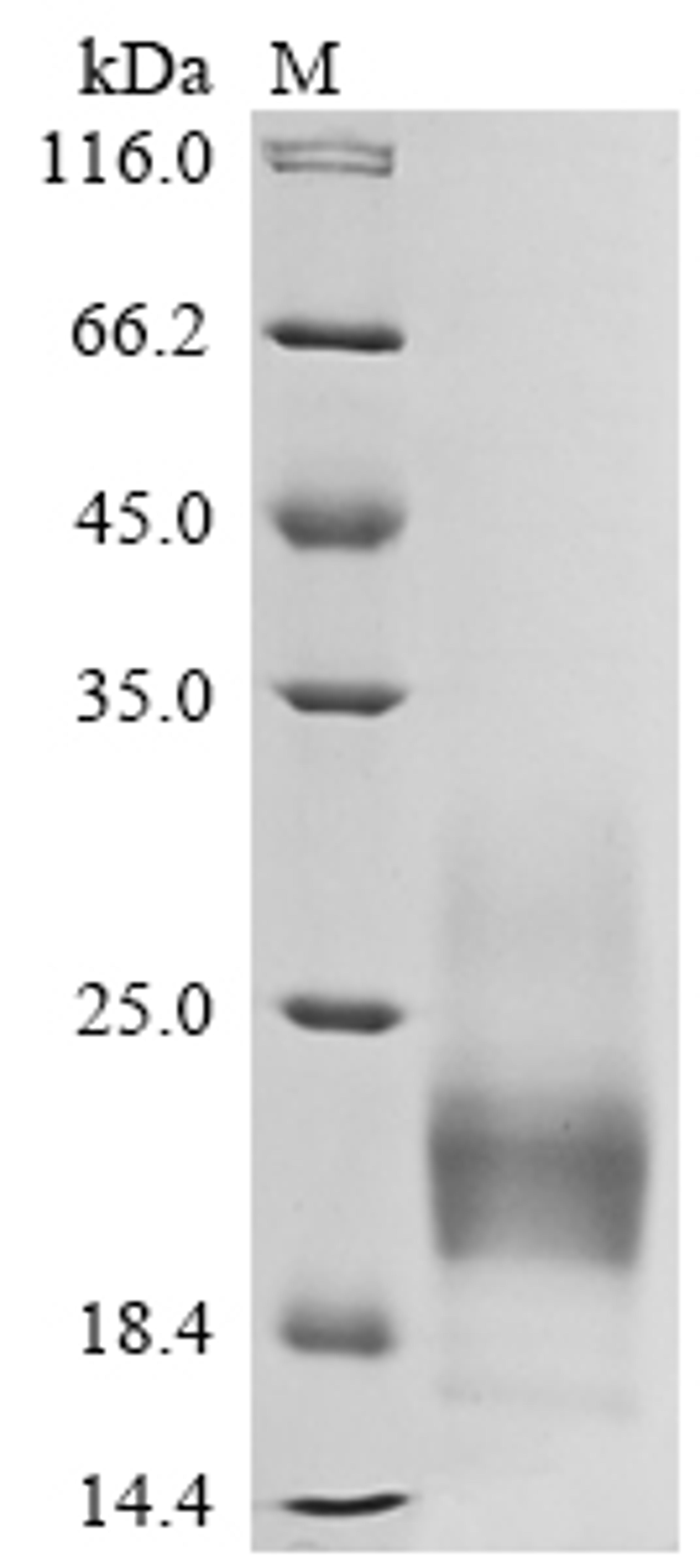 (Tris-Glycine gel) Discontinuous SDS-PAGE (reduced) with 5% enrichment gel and 15% separation gel.