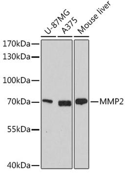 Western blot - MMP2 antibody (A6247)