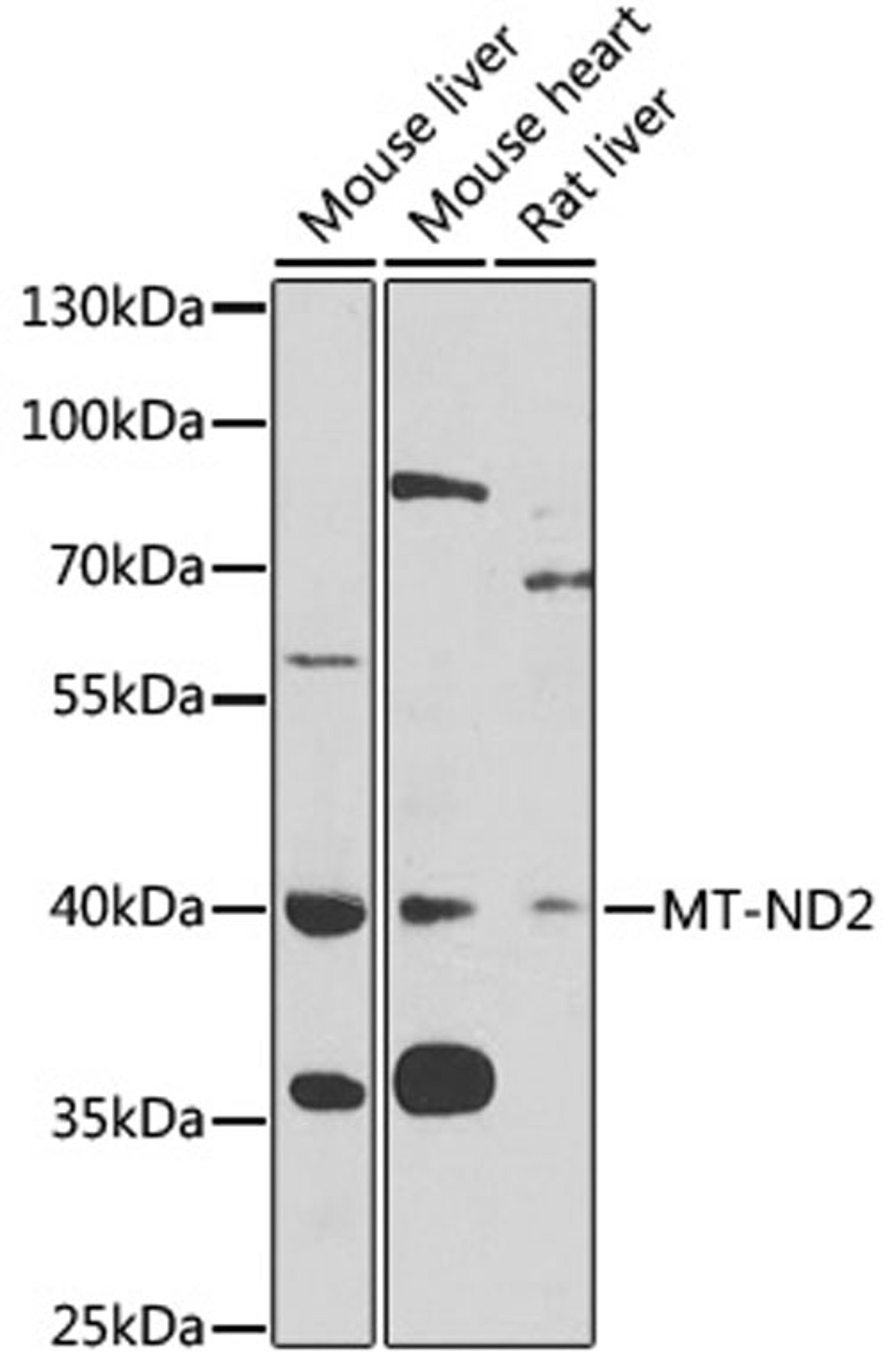 Western blot - MT-ND2 antibody (A6180)