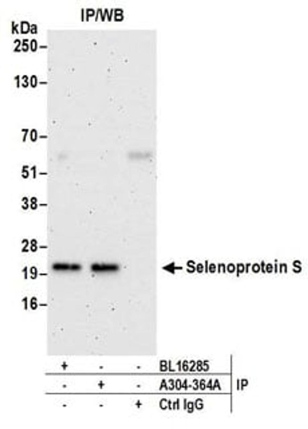 Detection of human Selenoprotein S by western blot of immunoprecipitates.