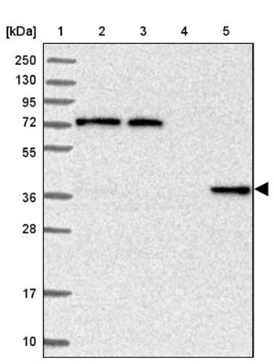 Western Blot: C11orf54 Antibody [NBP1-87193] - Lane 1: Marker [kDa] 250, 130, 95, 72, 55, 36, 28, 17, 10<br/>Lane 2: Human cell line RT-4<br/>Lane 3: Human cell line U-251MG sp<br/>Lane 4: Human plasma (IgG/HSA depleted)<br/>Lane 5: Human liver tissue