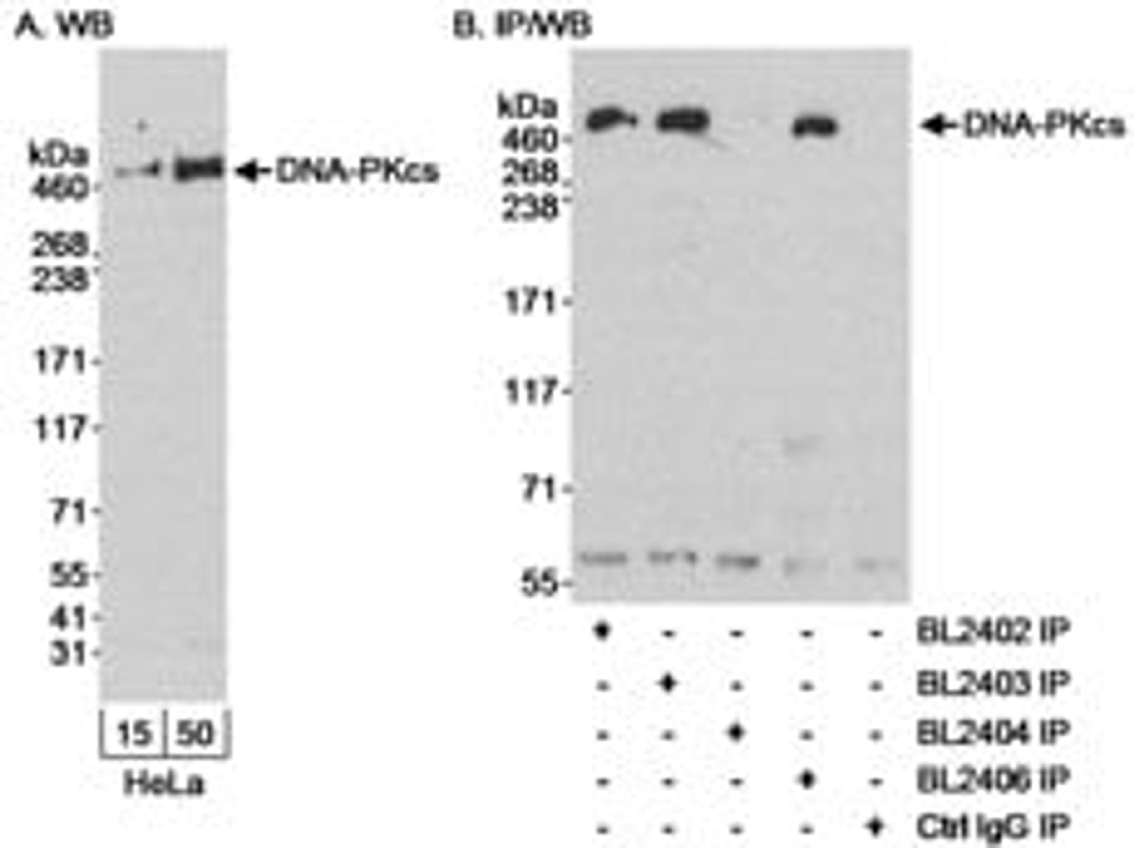 Detection of human DNA-PKcs by western blot and immunoprecipitation.