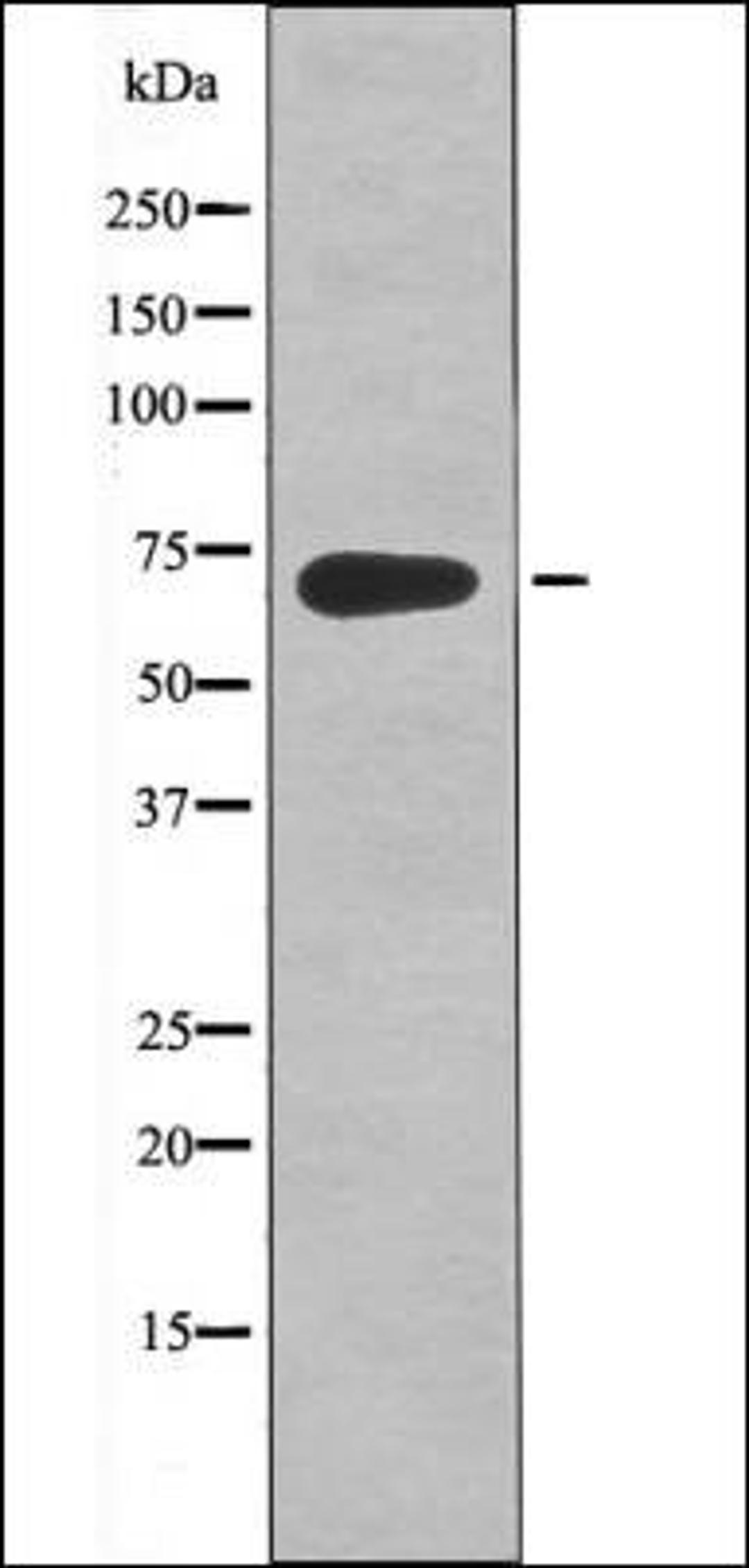 Western blot analysis of MDA-MB-435 whole cell lysates using Kv4.2/KCND2 -Phospho-Ser616- antibody