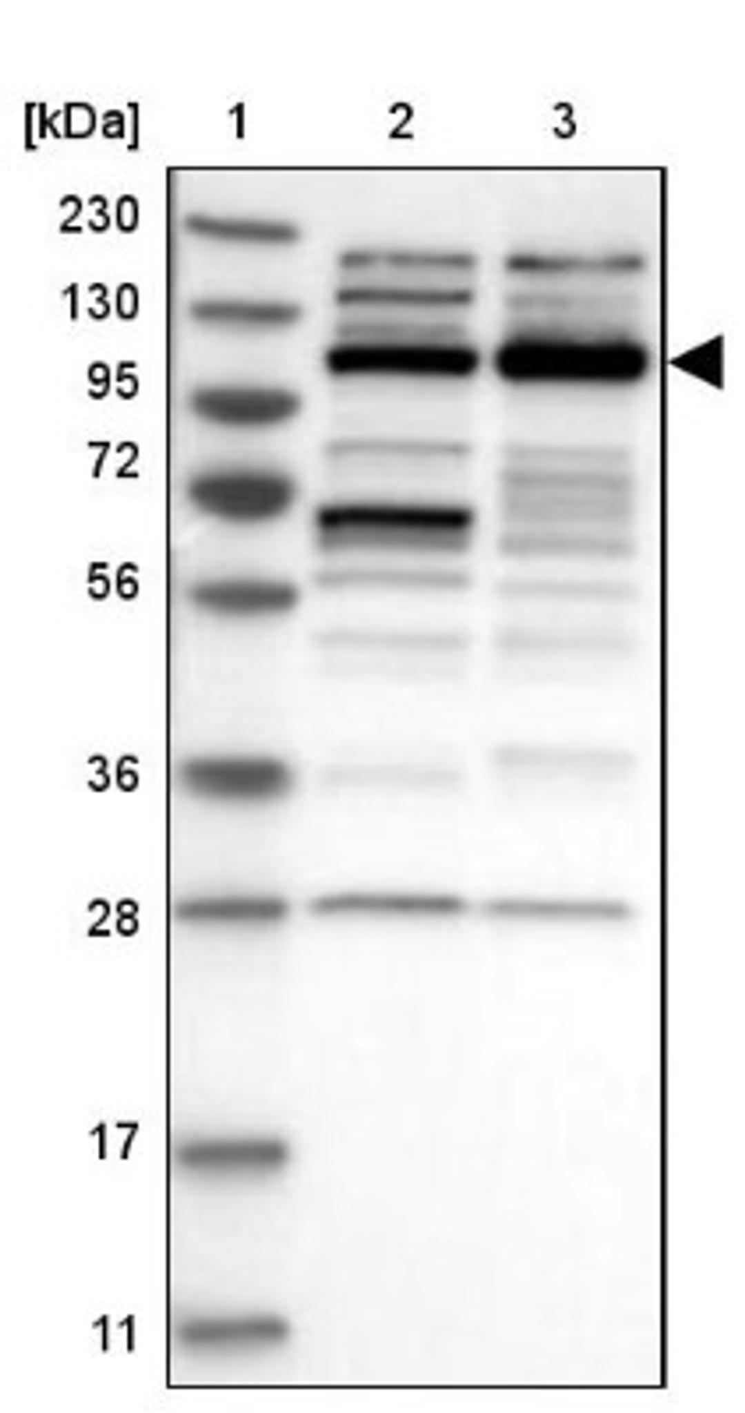 Western Blot: CHD1L Antibody [NBP1-89153] - Lane 1: Marker [kDa] 230, 130, 95, 72, 56, 36, 28, 17, 11<br/>Lane 2: Human cell line RT-4<br/>Lane 3: Human cell line U-251MG sp