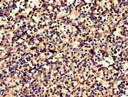 Immunohistochemistry of paraffin-embedded human spleen tissue using CSB-PA005679LA01HU at dilution of 1:100