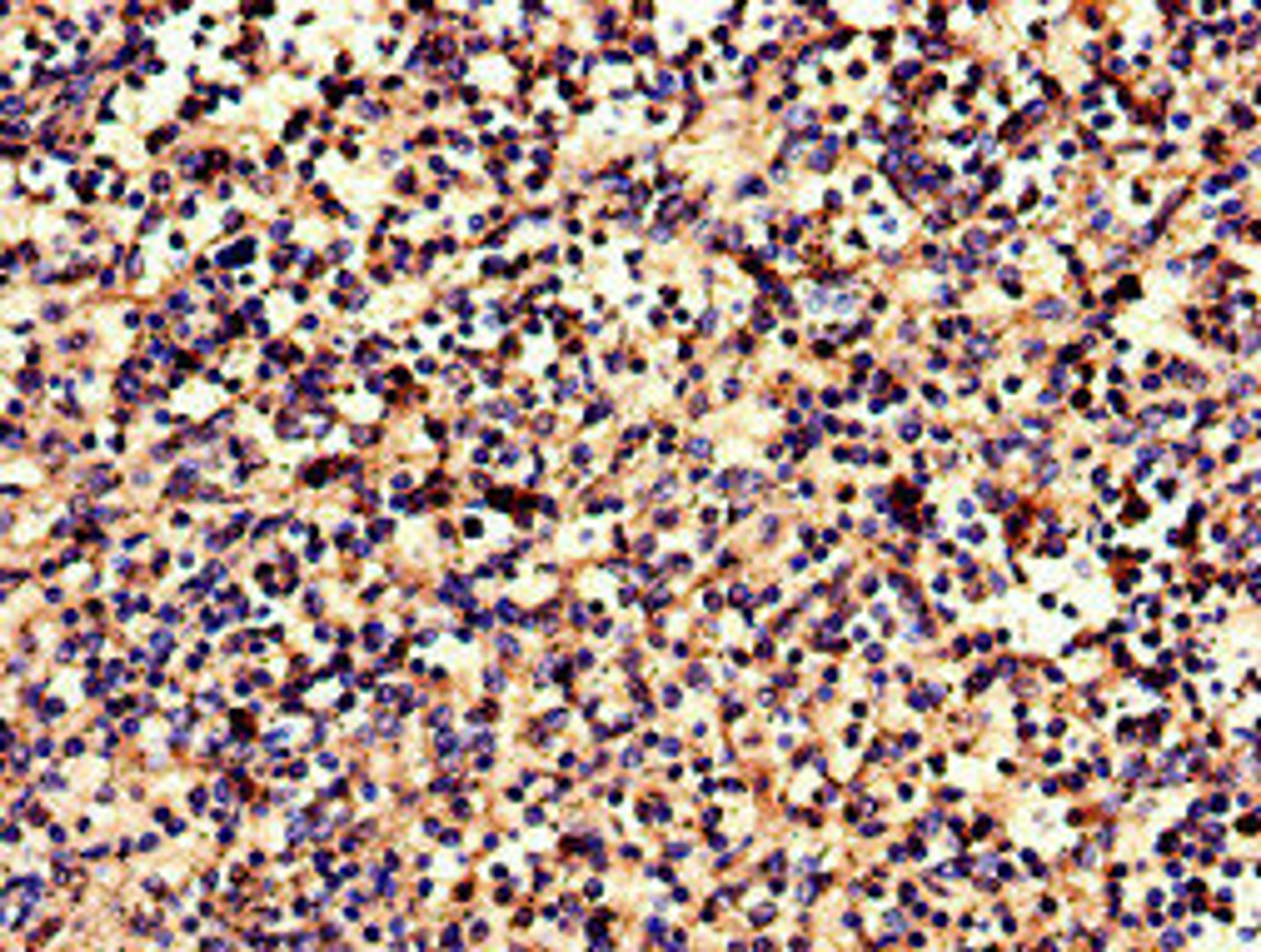 Immunohistochemistry of paraffin-embedded human spleen tissue using CSB-PA005679LA01HU at dilution of 1:100