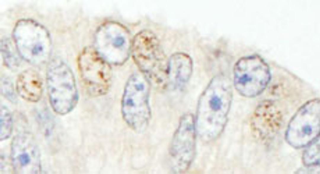 Detection of human NCOA62 by immunohistochemistry.