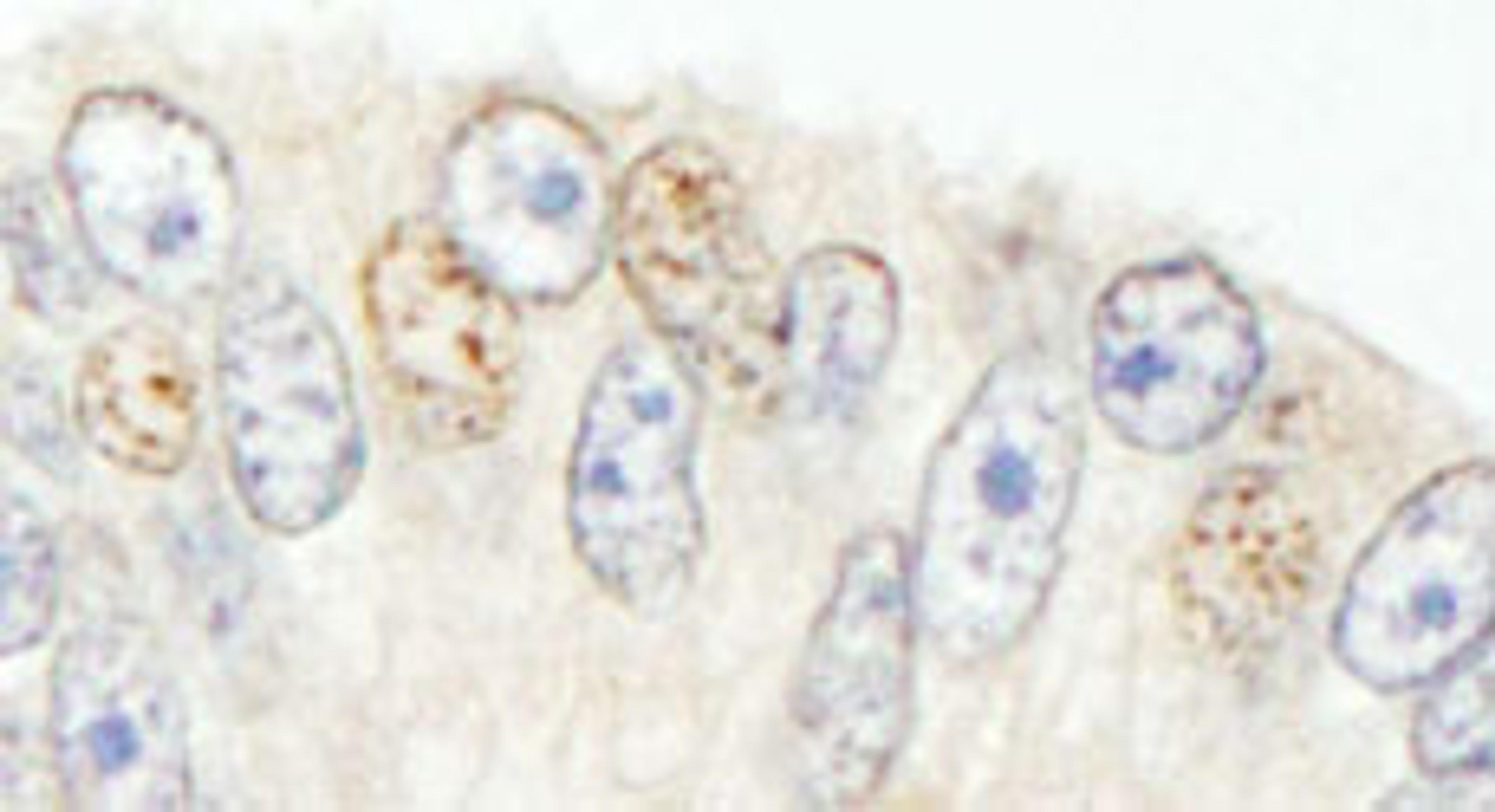 Detection of human NCOA62 by immunohistochemistry.