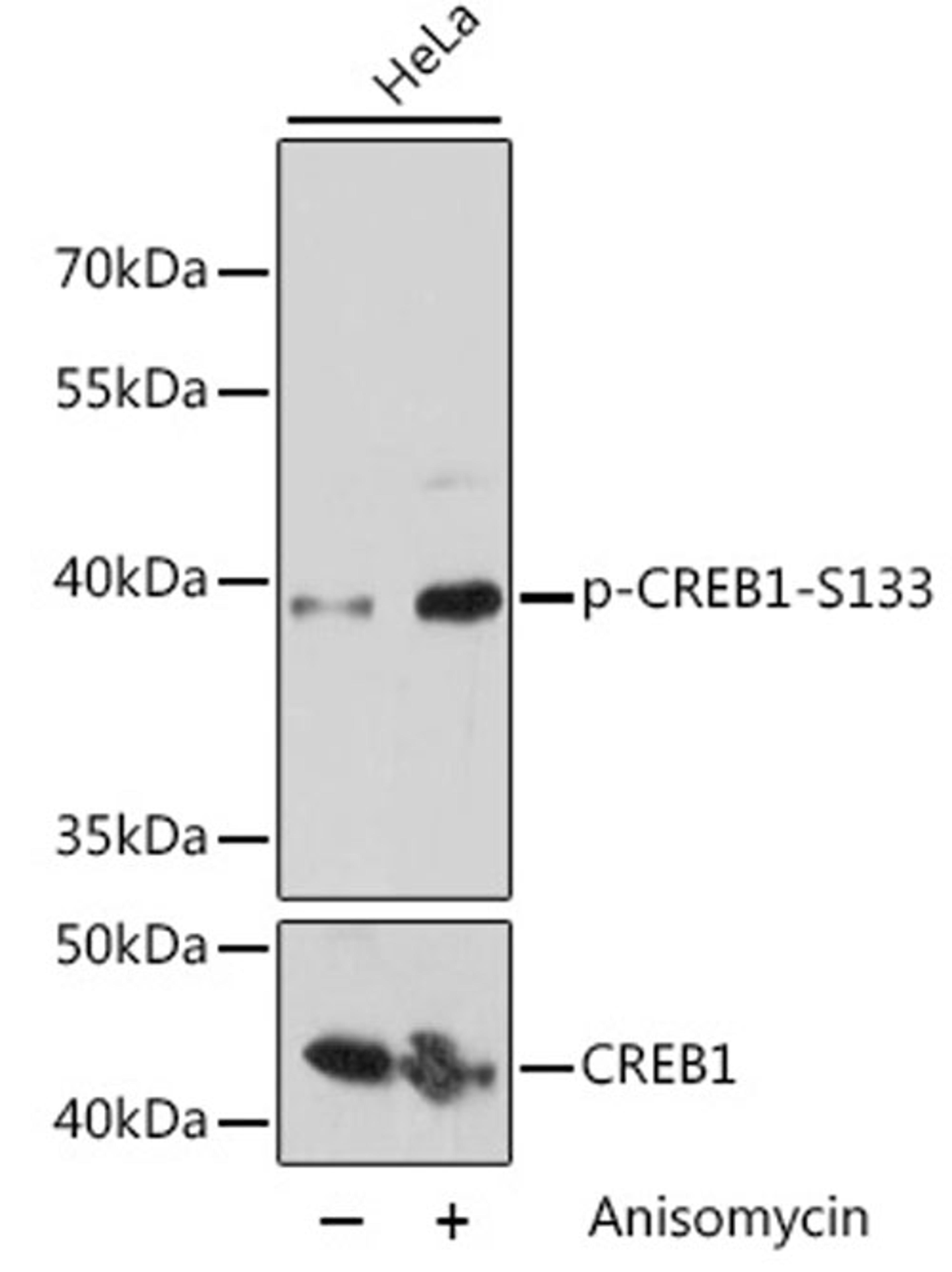 Western blot - Phospho-CREB1-S133 pAb (AP0019)