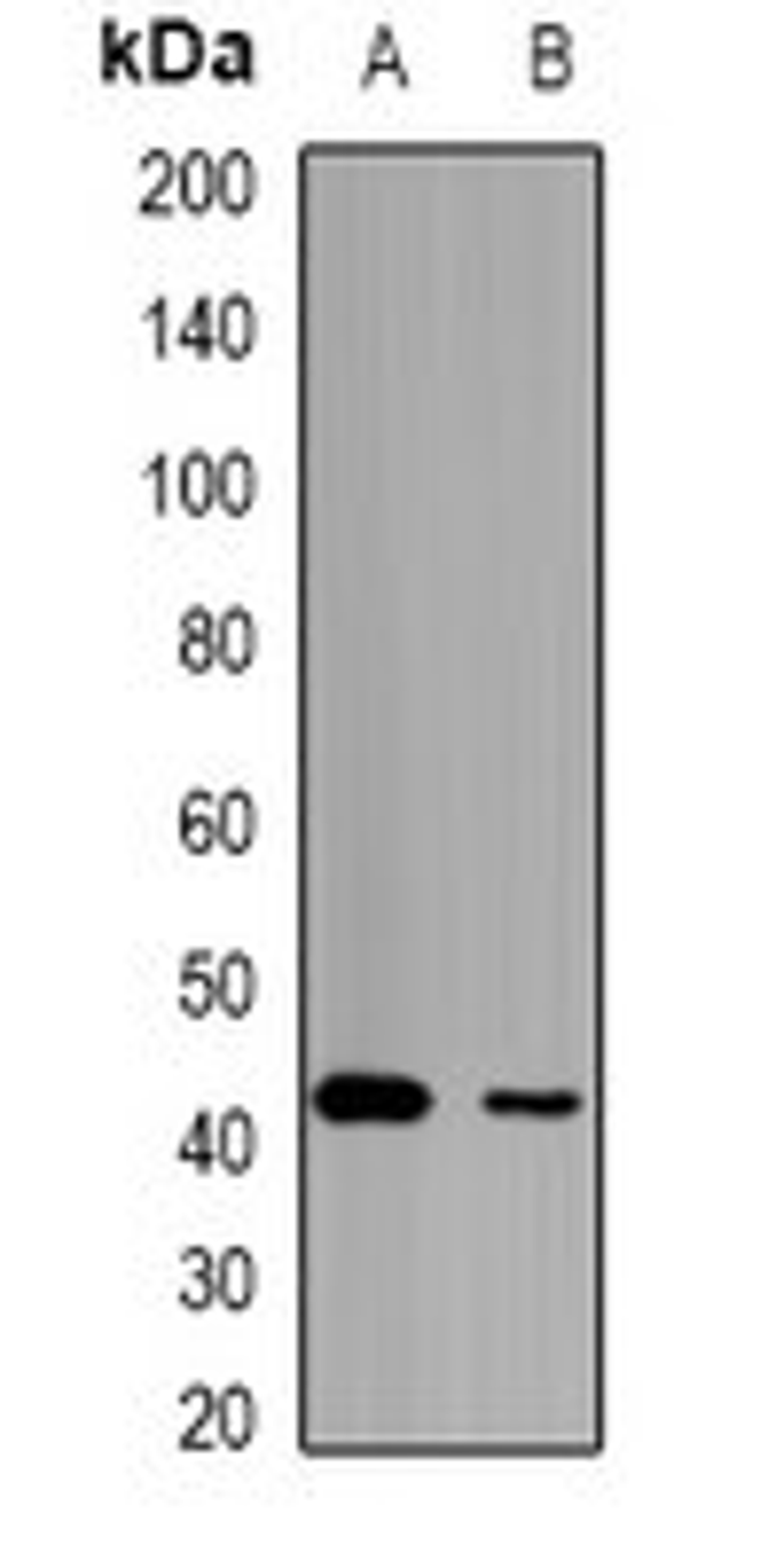 Western blot analysis of mouse kidney (Lane1), mouse liver (Lane2) whole cell lysates using LETMD1 antibody