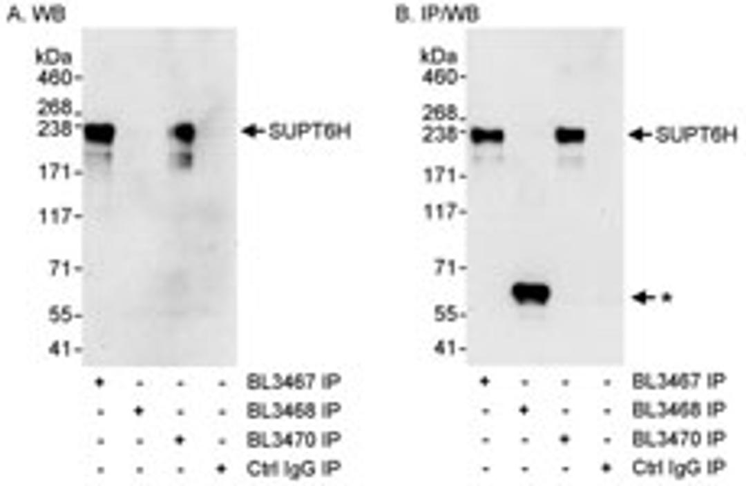 Detection of human SUPT6H by western blot of immunoprecipitates.