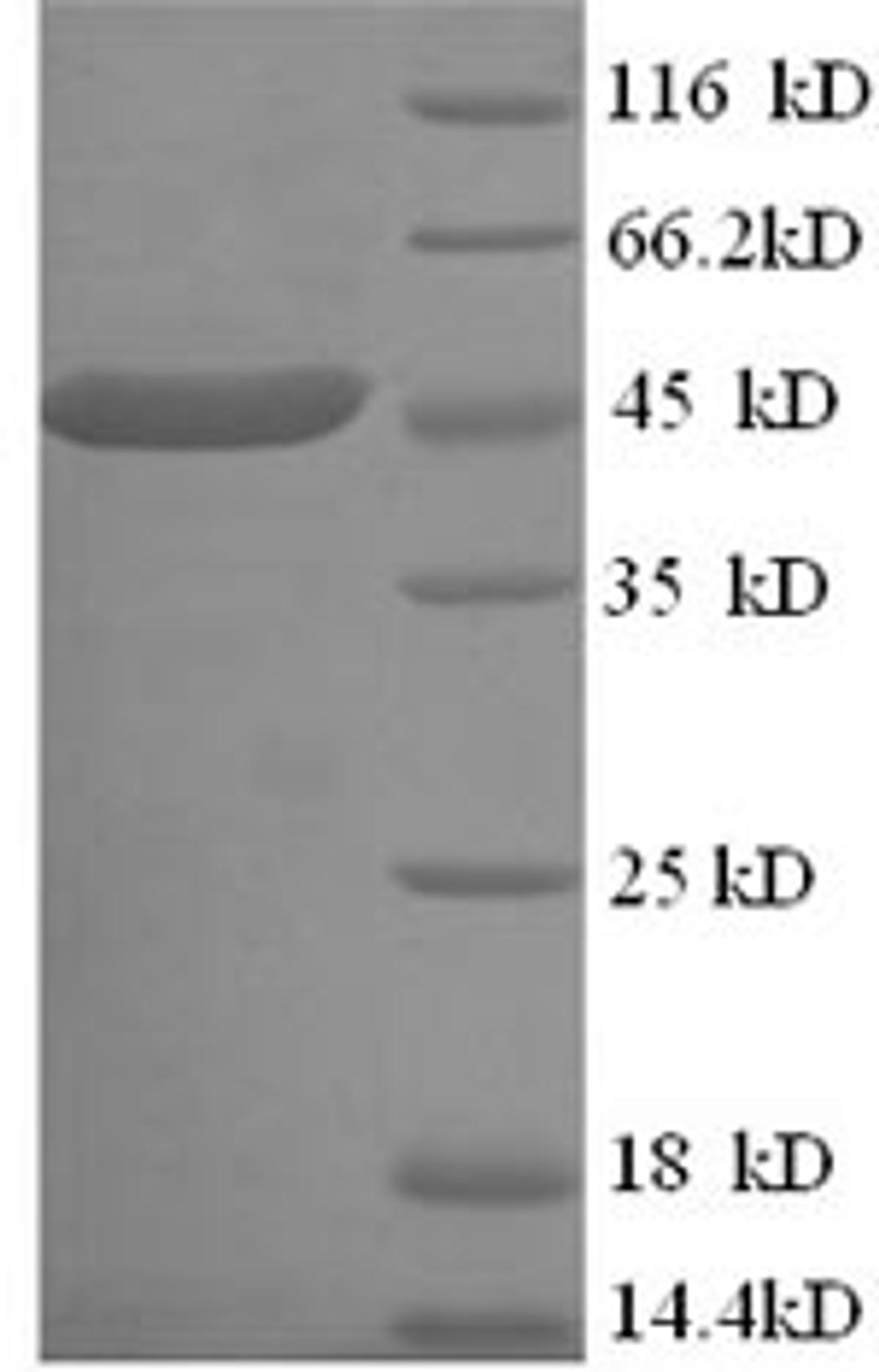 (Tris-Glycine gel) Discontinuous SDS-PAGE (reduced) with 5% enrichment gel and 15% separation gel.
